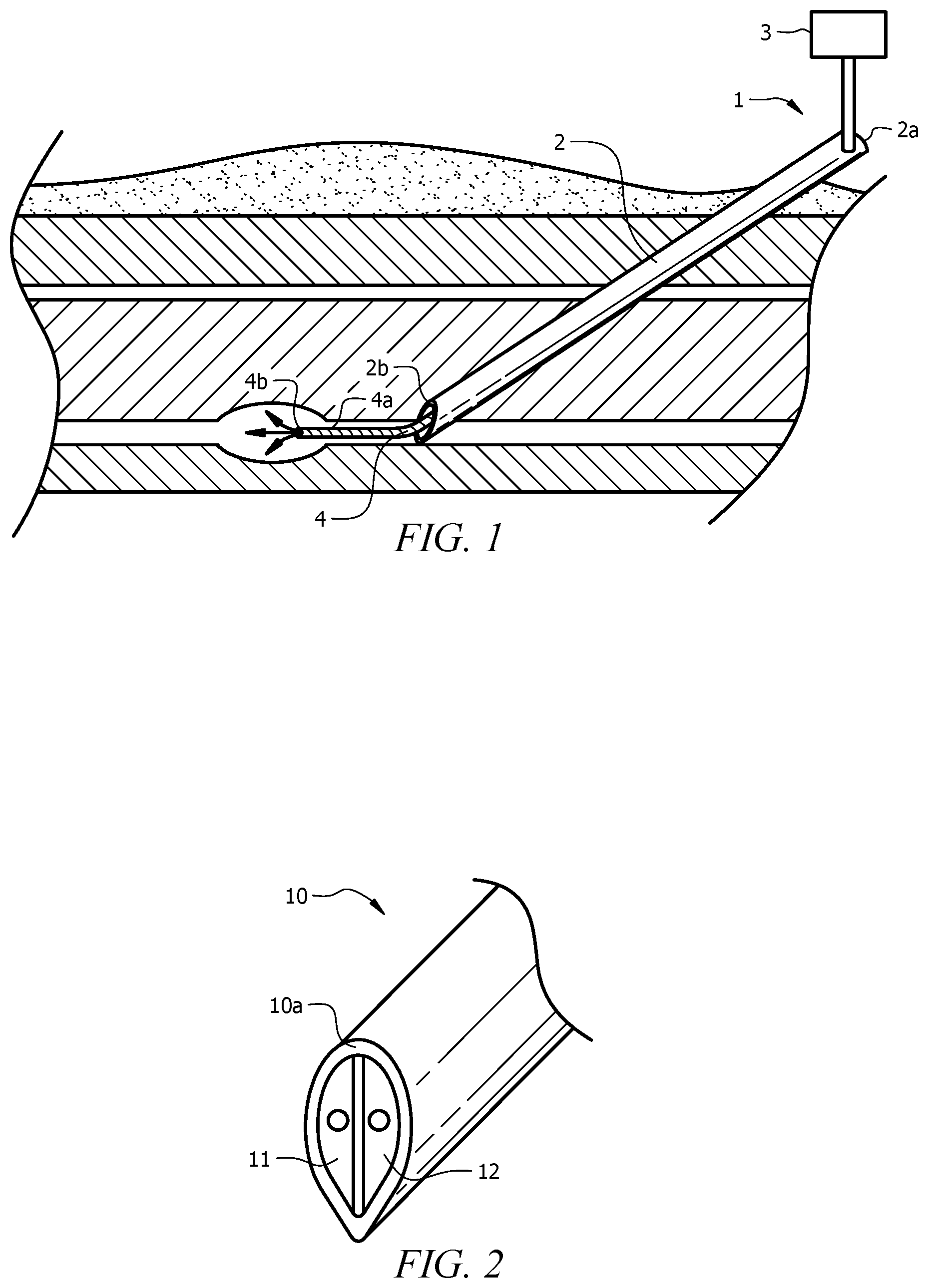 Patent US12318548 Figure 1 – Medical device for use in a nerve block procedure that obviates the need for injecting test doses and a method