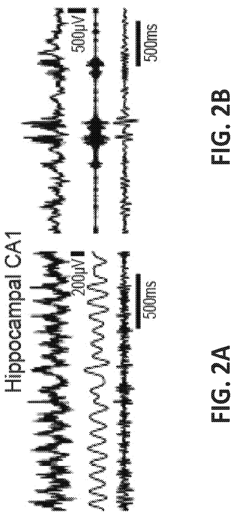 Patent US12318549 Figure 2 – Methods and devices for providing a stimulus to a subject to induce gamma oscillations