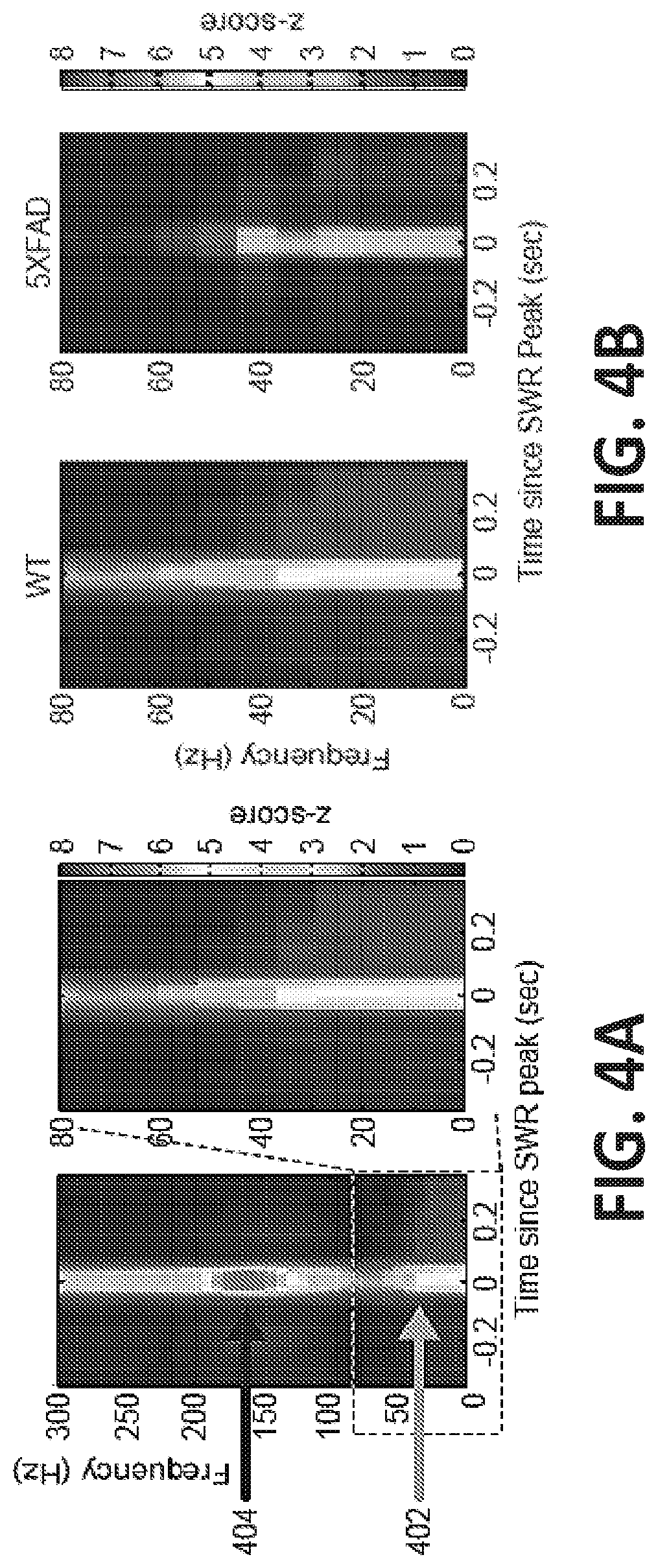 Patent US12318549 Figure 4 – Methods and devices for providing a stimulus to a subject to induce gamma oscillations