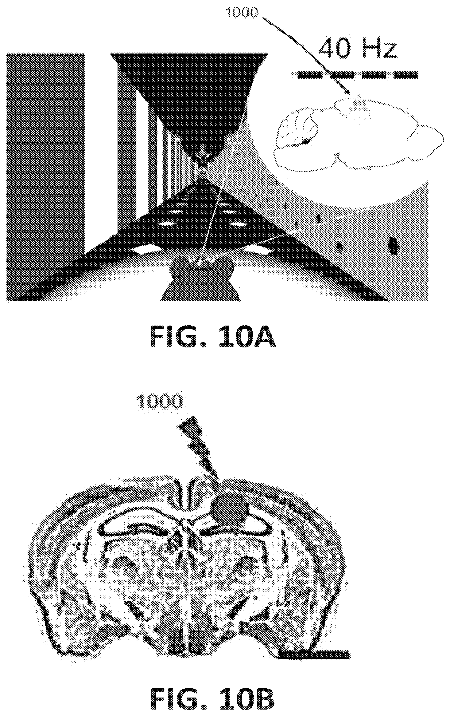 Patent US12318549 Figure 10 – Methods and devices for providing a stimulus to a subject to induce gamma oscillations