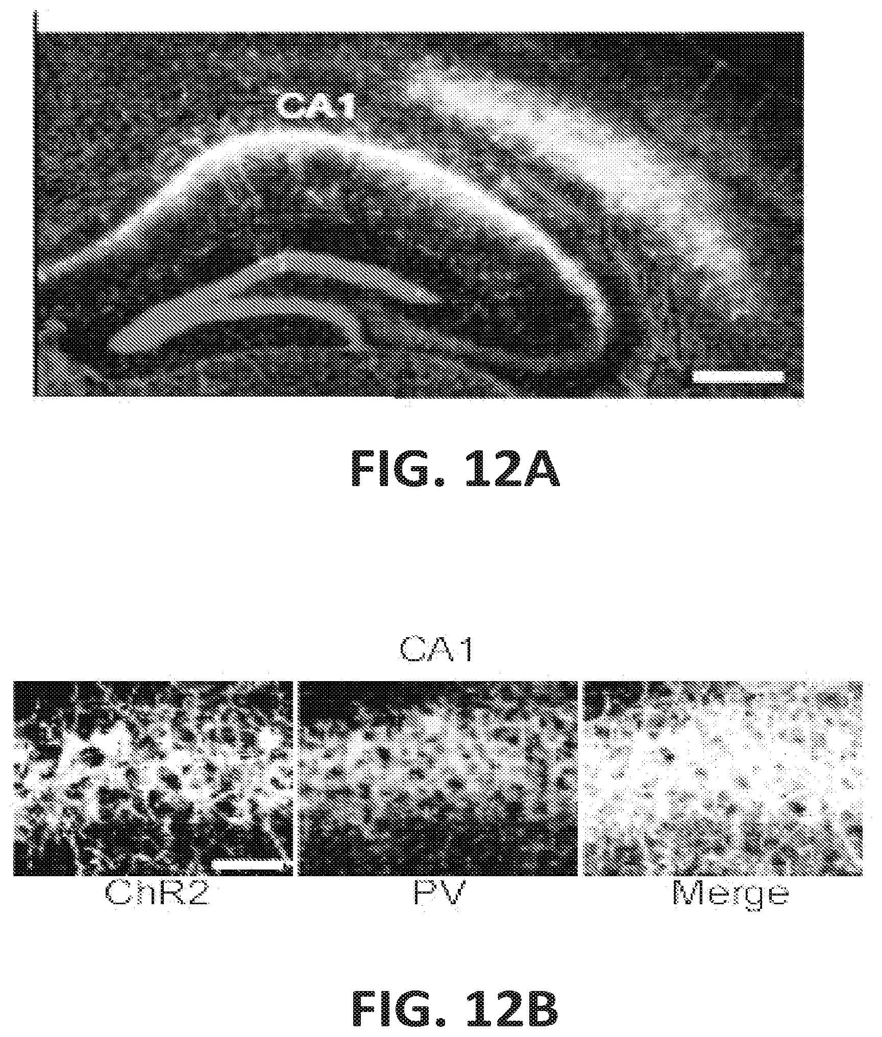 Patent US12318549 Figure 12 – Methods and devices for providing a stimulus to a subject to induce gamma oscillations