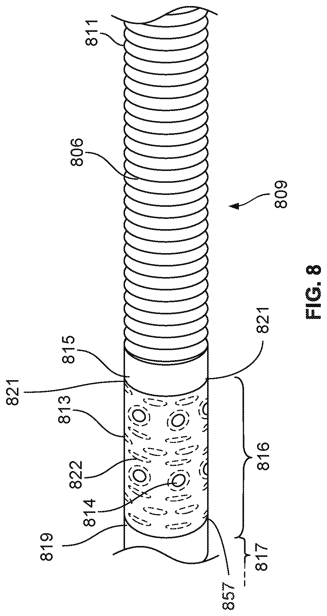 Patent US12318551 Figure 7 – Cannula having nitinol reinforced inflow region