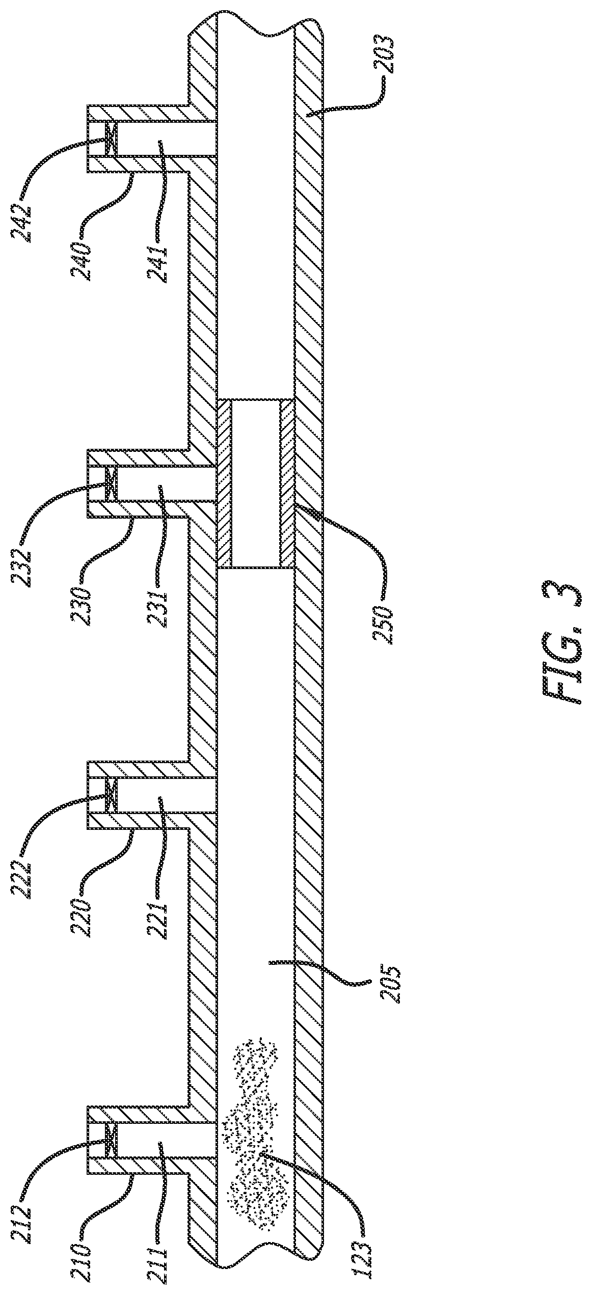 Patent US12318552 Figure 4 – Collapsible thin-walled valve for drainage control