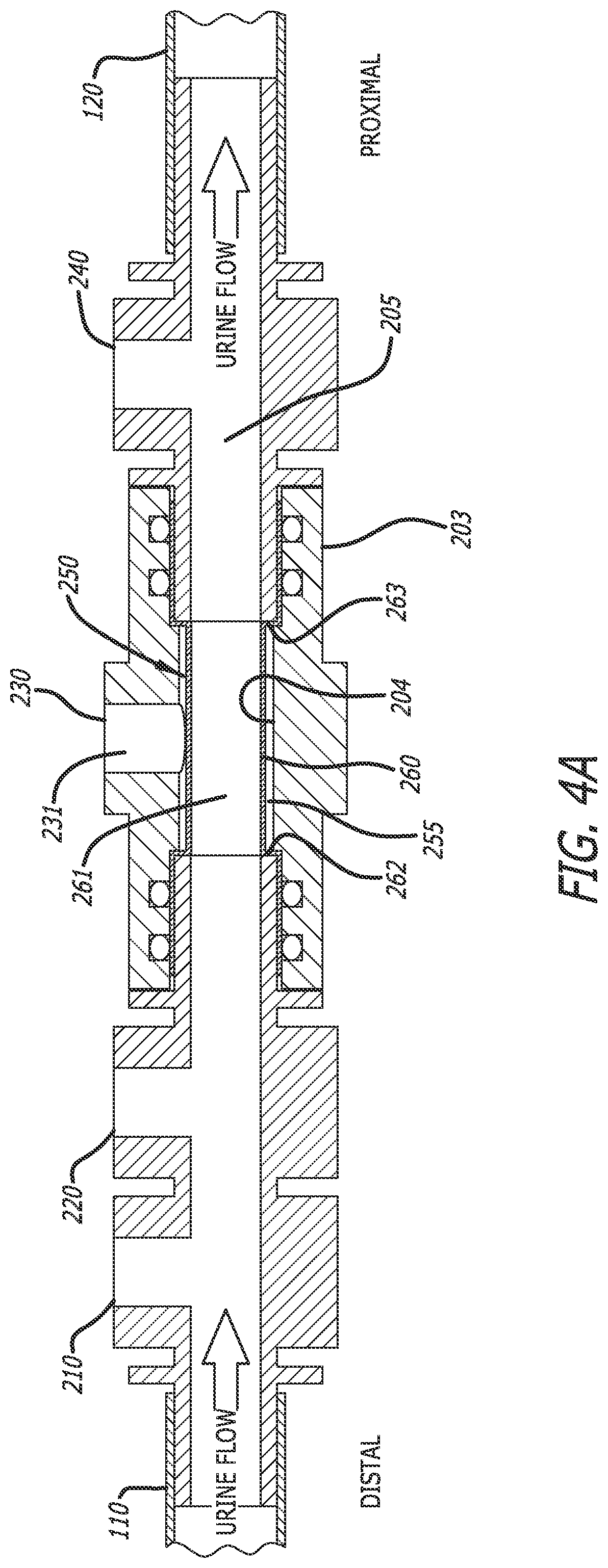 Patent US12318552 Figure 5 – Collapsible thin-walled valve for drainage control