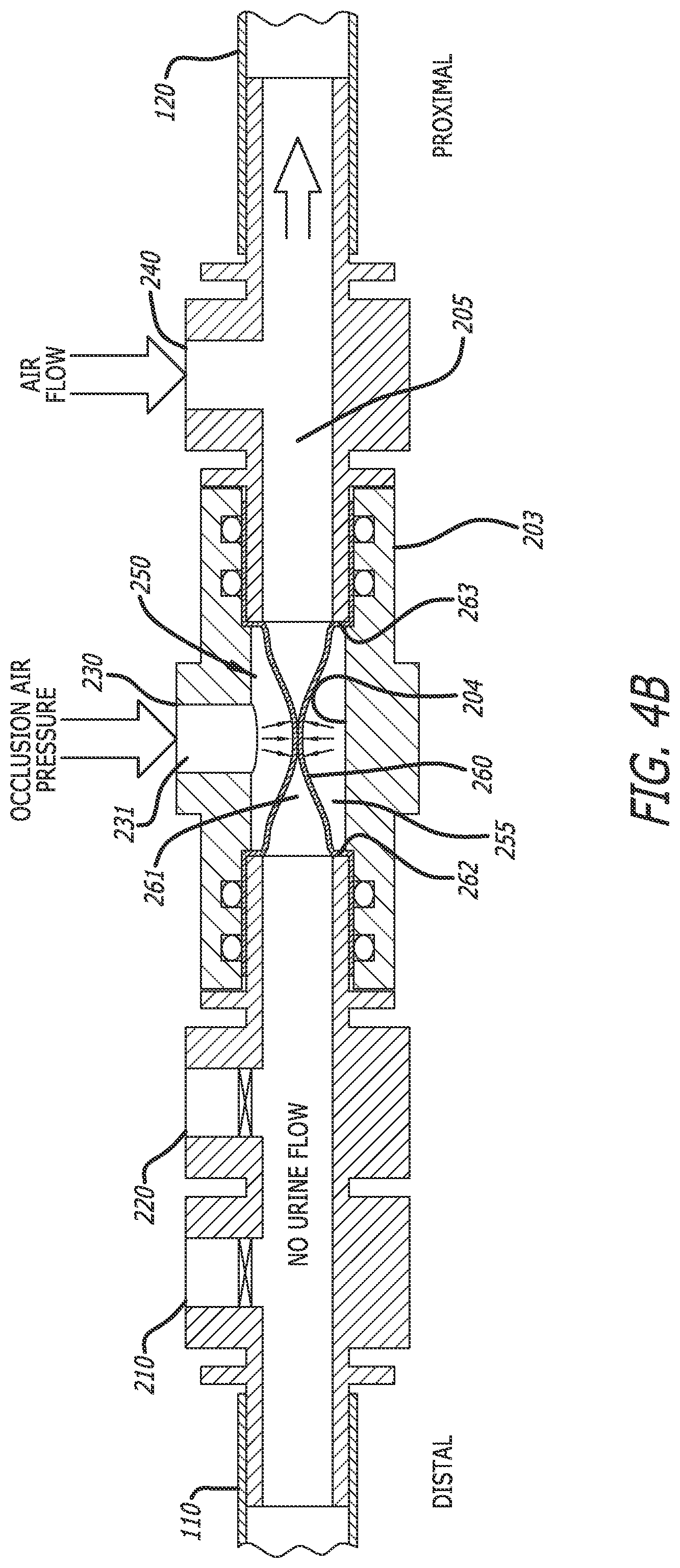 Patent US12318552 Figure 6 – Collapsible thin-walled valve for drainage control