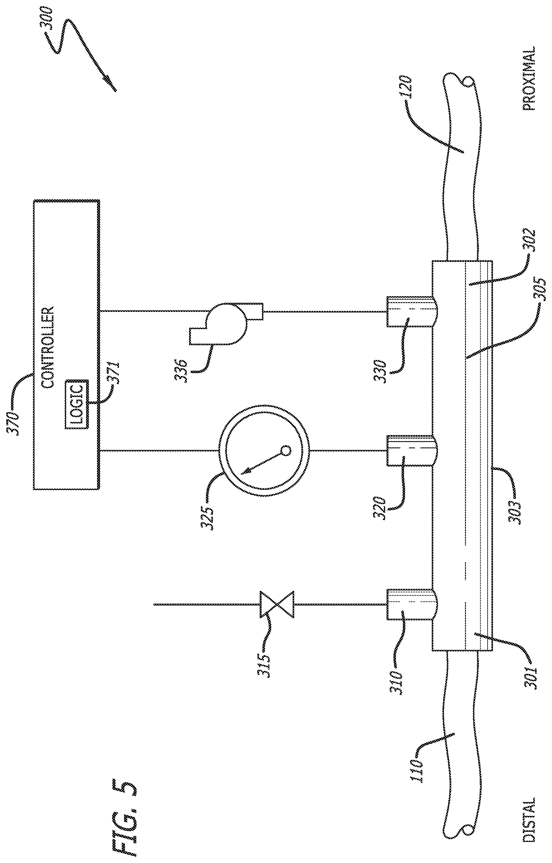 Patent US12318552 Figure 7 – Collapsible thin-walled valve for drainage control