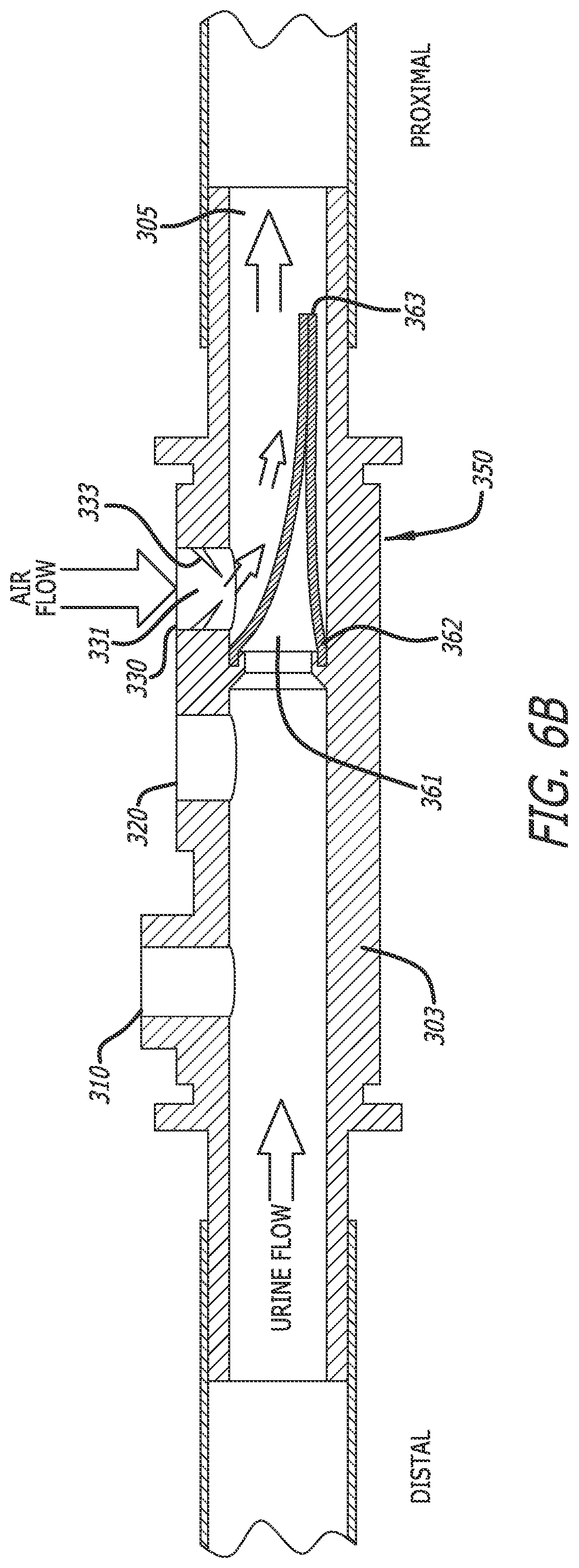 Patent US12318552 Figure 9 – Collapsible thin-walled valve for drainage control