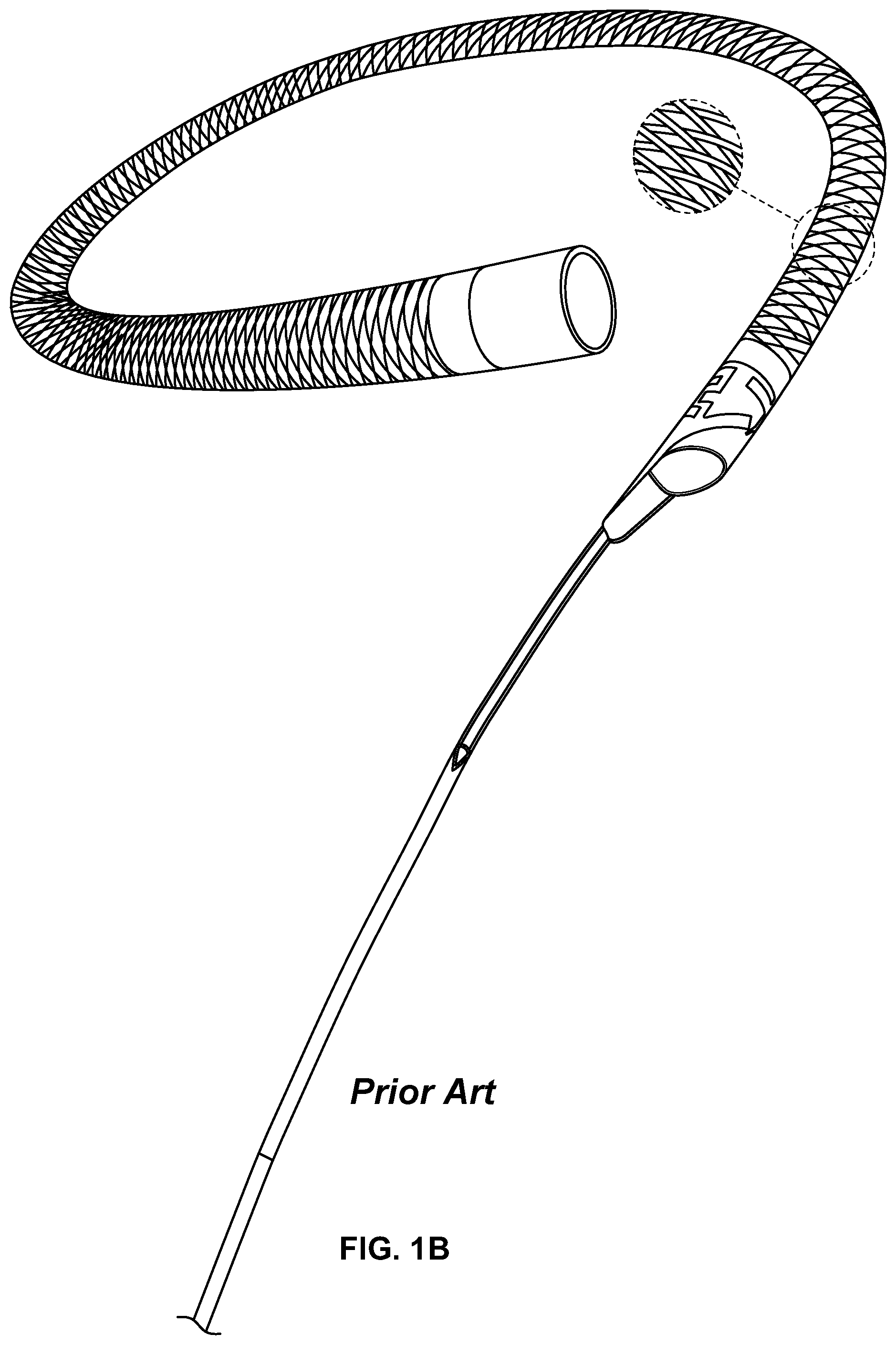 Patent US12318556 Figure 2 – Progressive flexibility catheter support frame