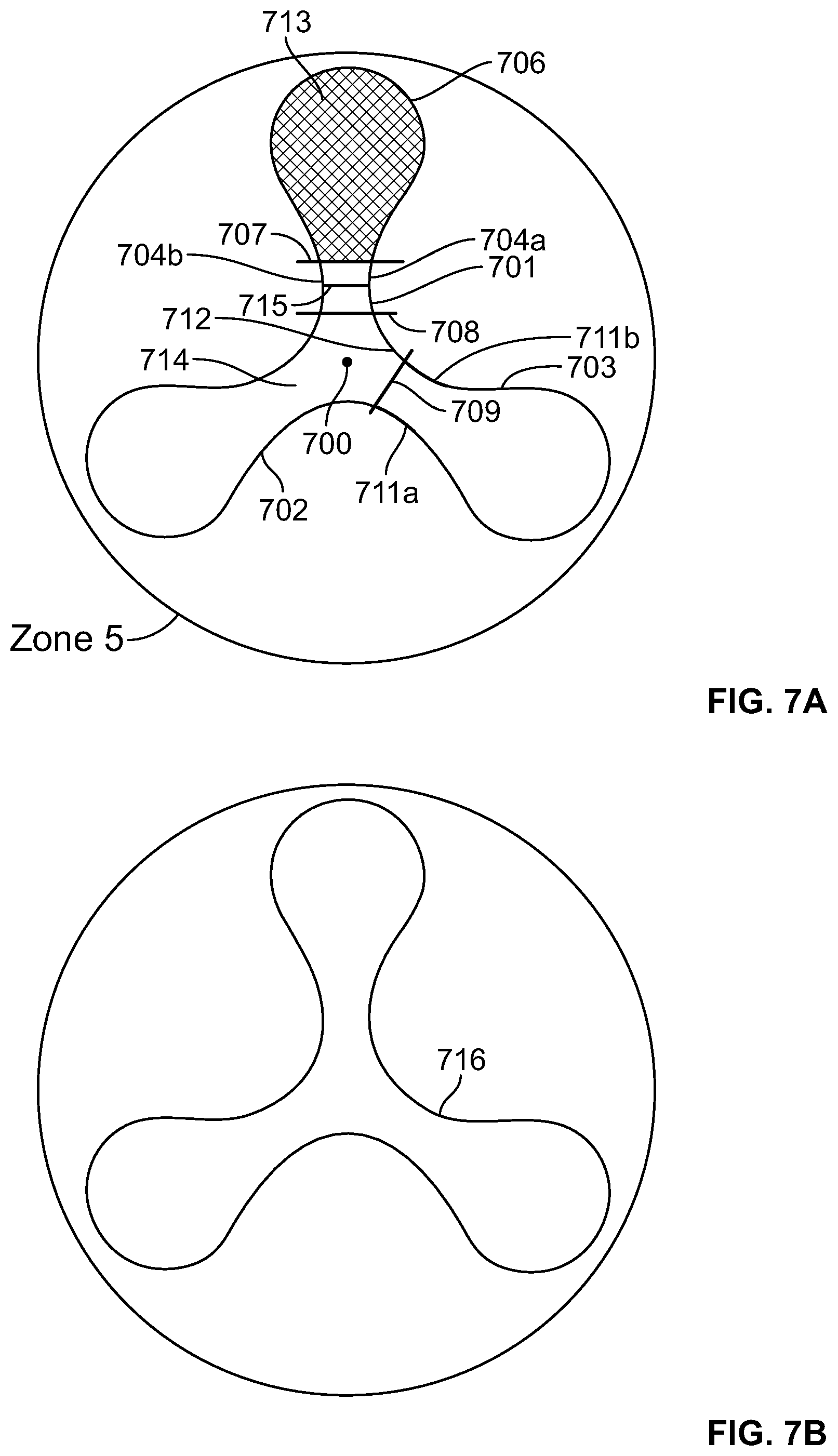 Patent US12318556 Figure 11 – Progressive flexibility catheter support frame