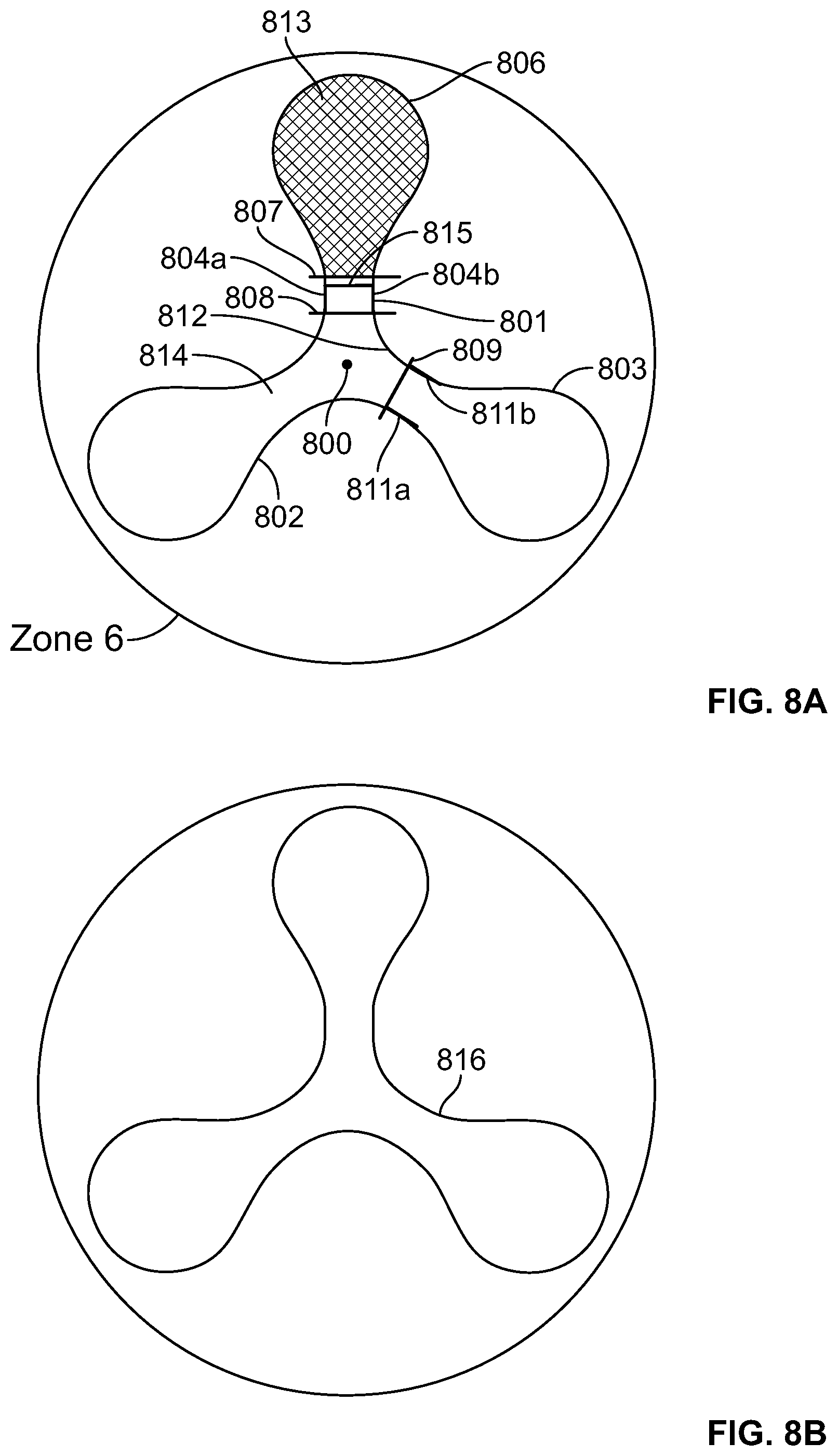 Patent US12318556 Figure 12 – Progressive flexibility catheter support frame