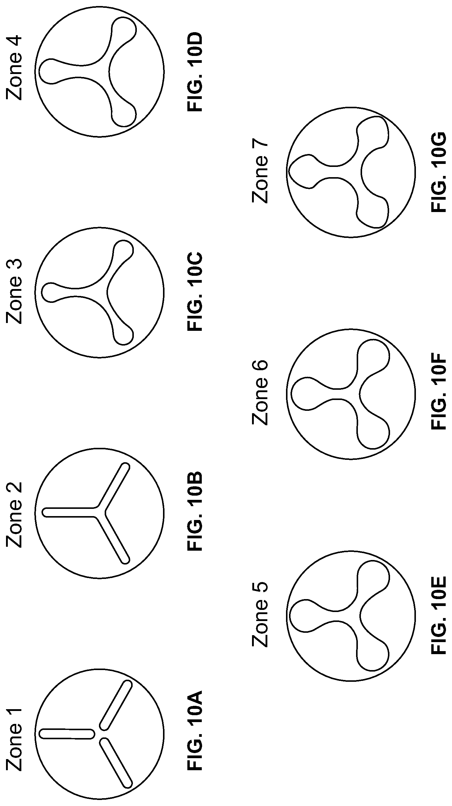 Patent US12318556 Figure 14 – Progressive flexibility catheter support frame