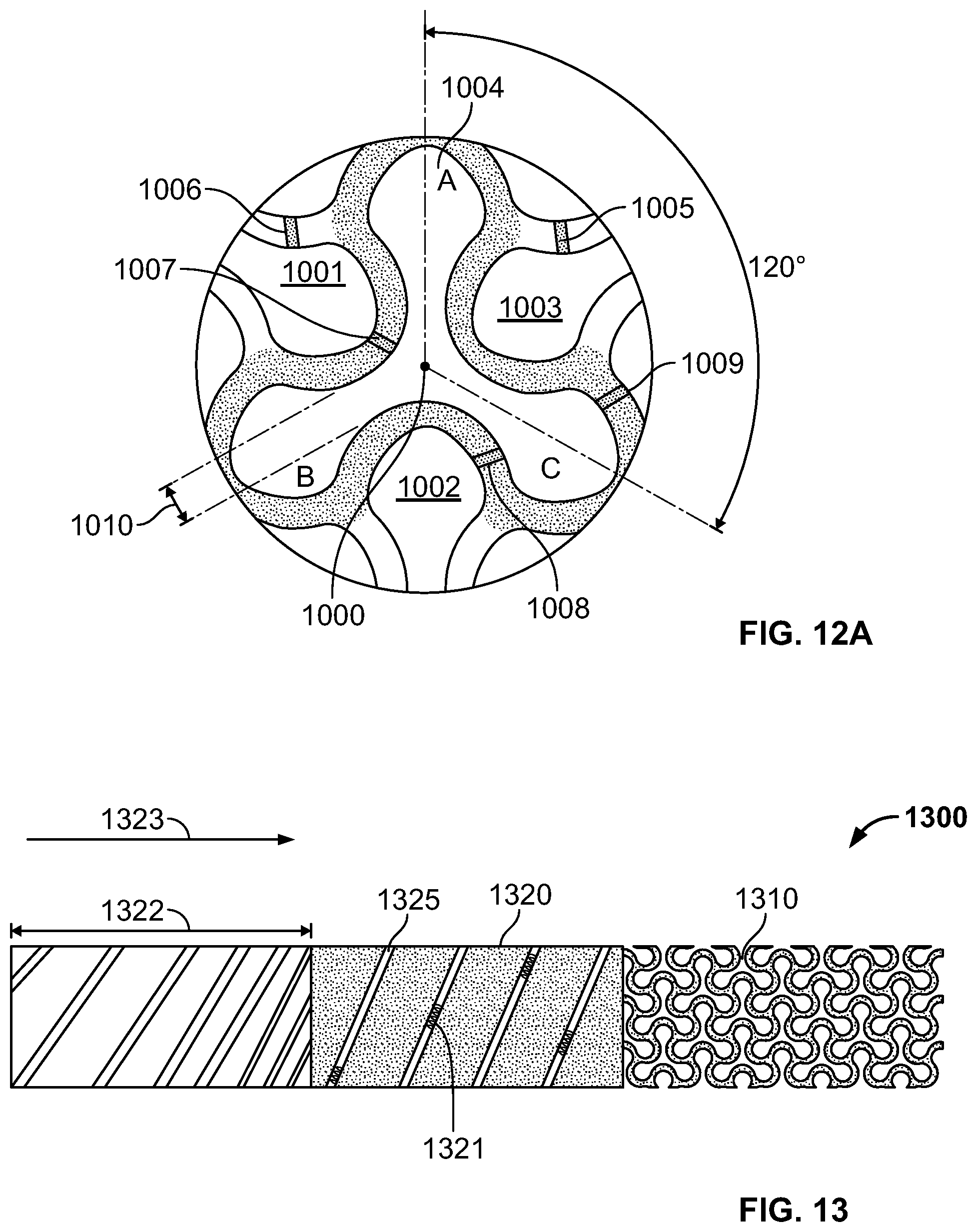 Patent US12318556 Figure 18 – Progressive flexibility catheter support frame