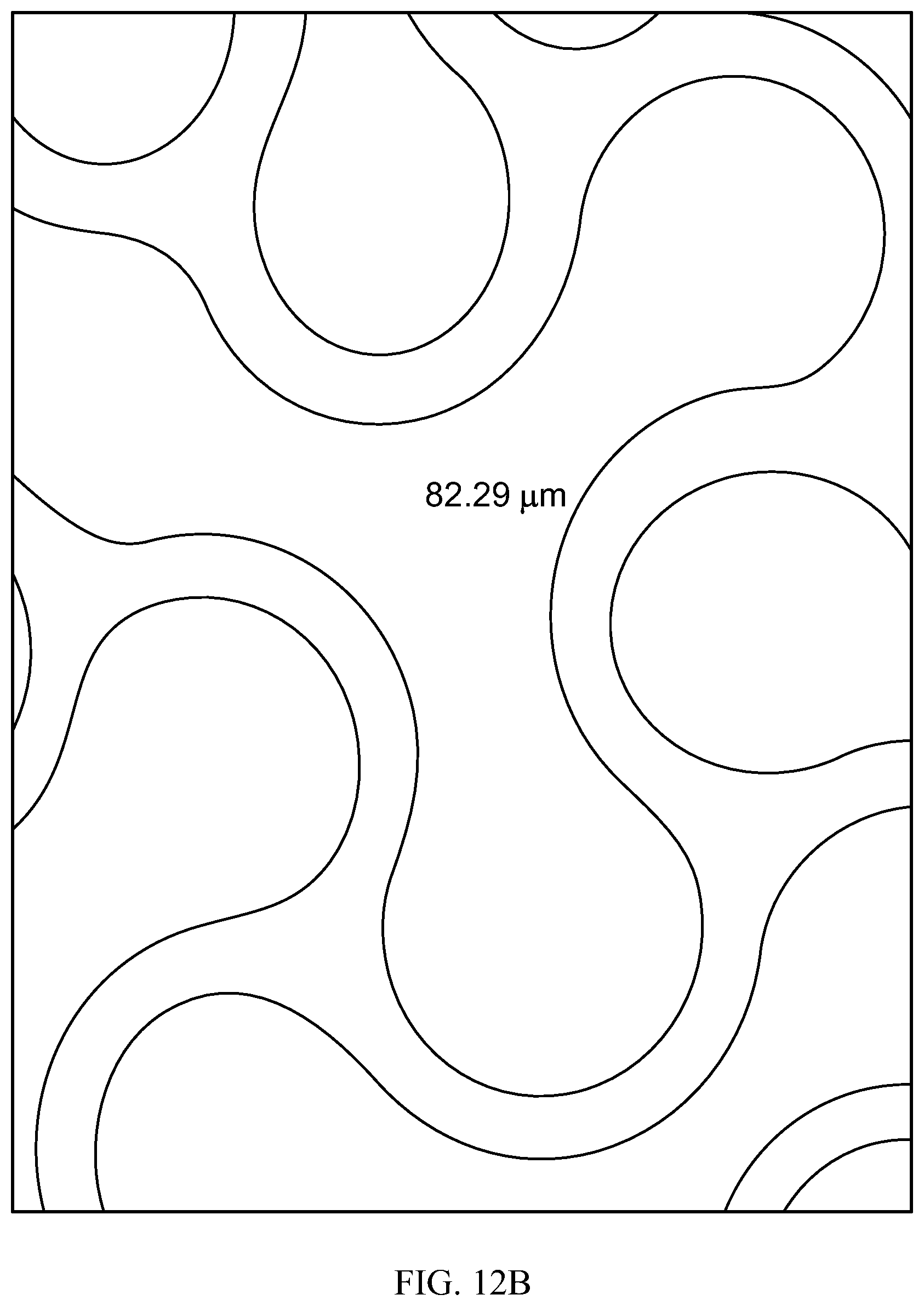 Patent US12318556 Figure 19 – Progressive flexibility catheter support frame