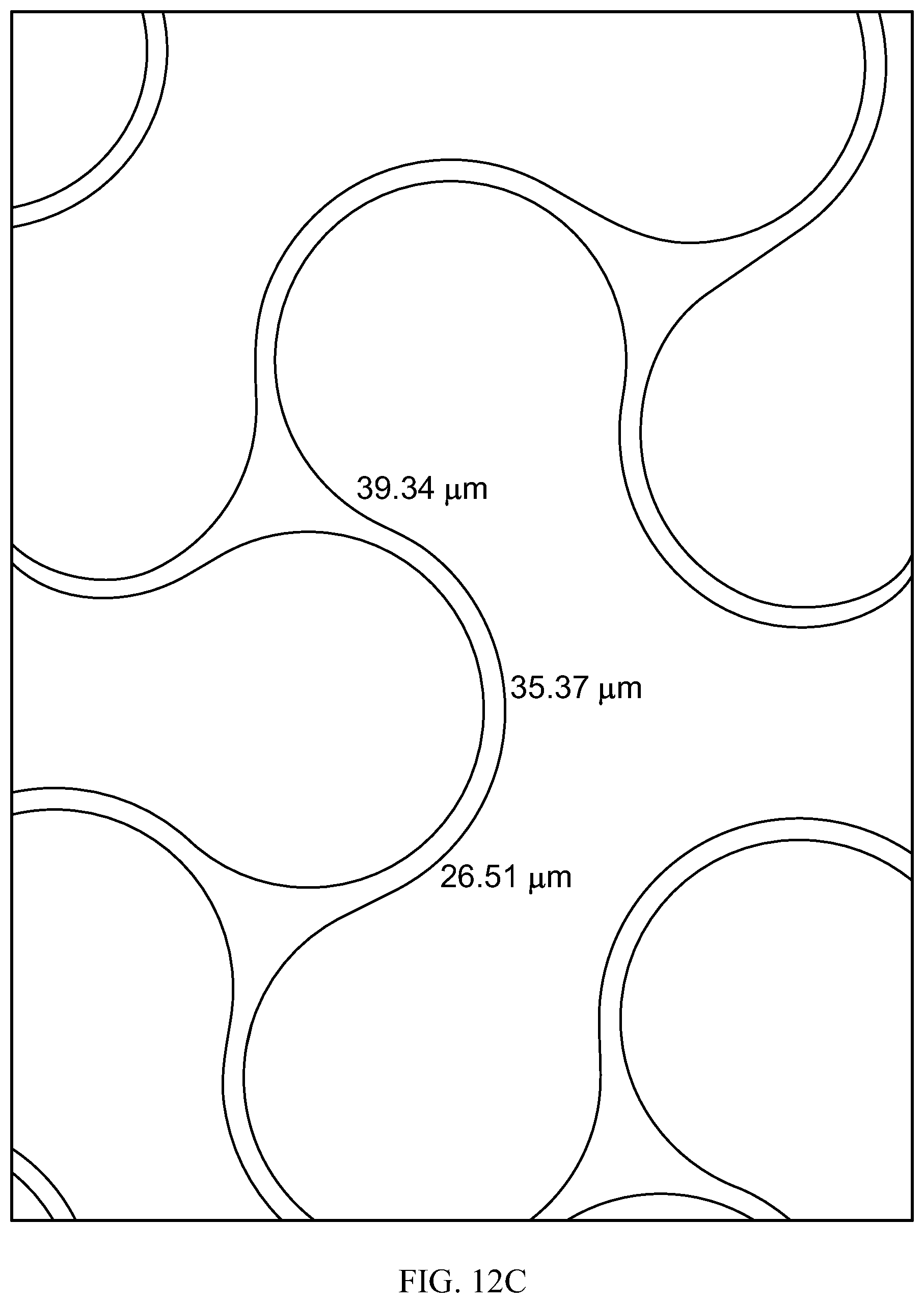 Patent US12318556 Figure 20 – Progressive flexibility catheter support frame