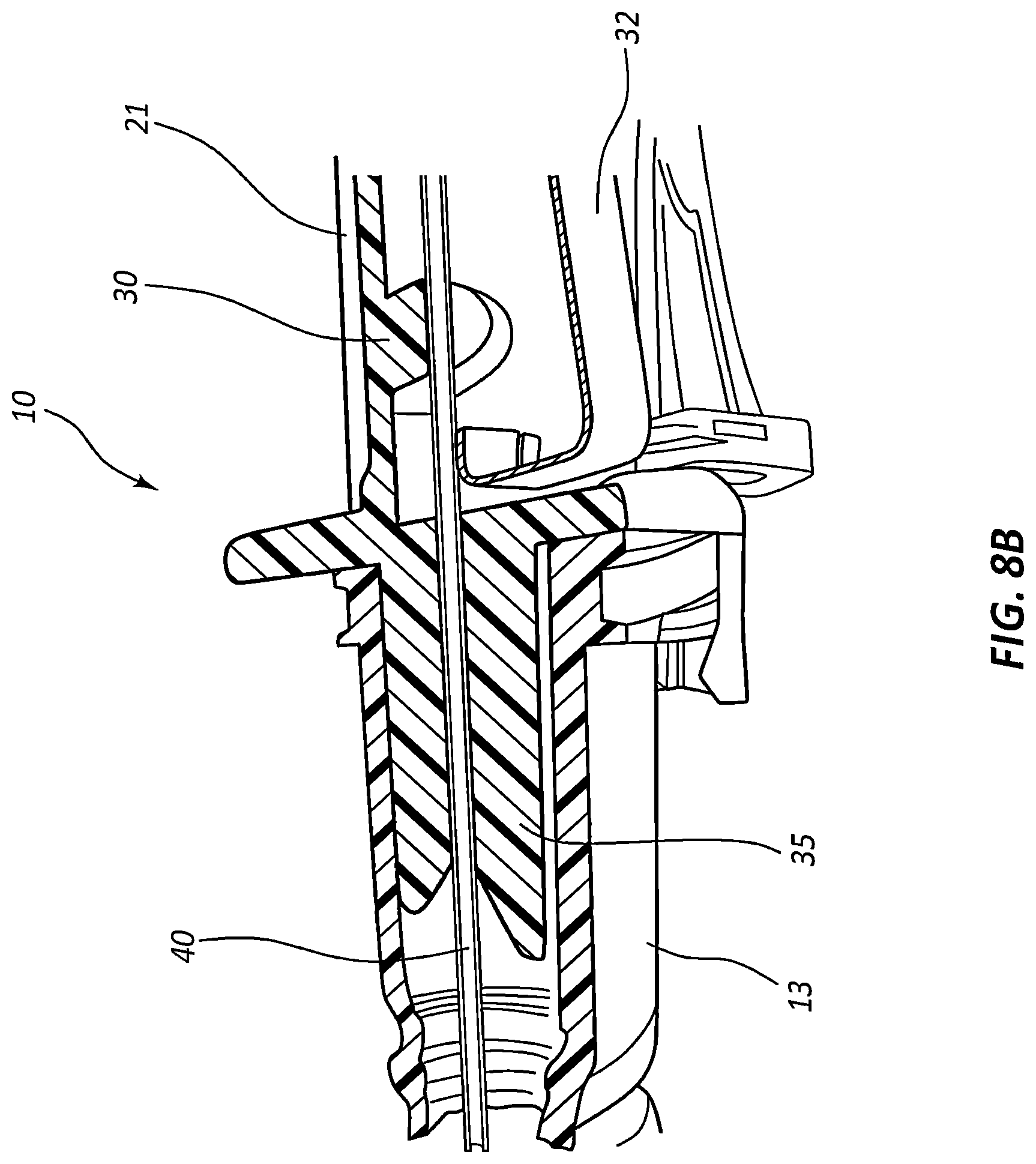 Patent US12318559 Figure 20 – Ported IV catheter having external needle shield and internal blood control septum