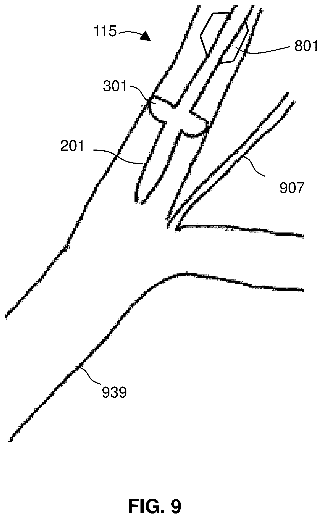 Patent US12318561 Figure 9 – Devices and methods for treating edema
