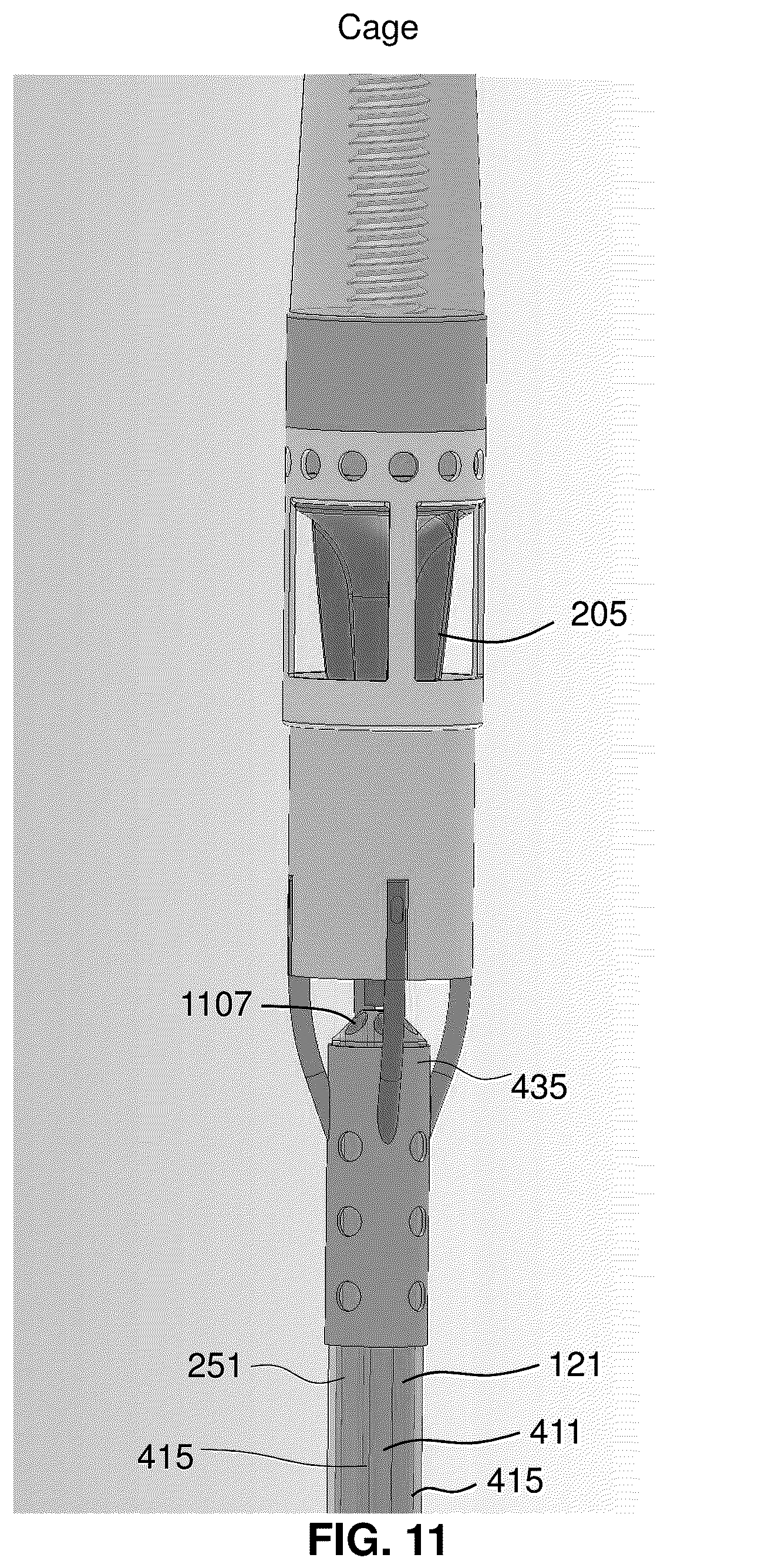 Patent US12318561 Figure 11 – Devices and methods for treating edema
