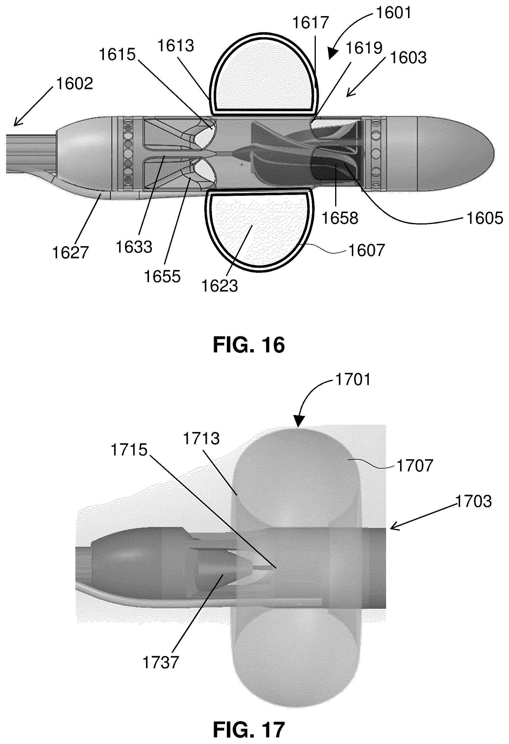 Patent US12318561 Figure 16 – Devices and methods for treating edema