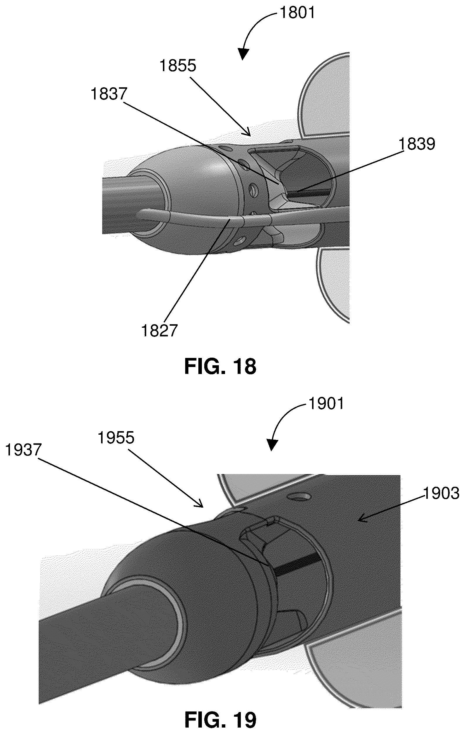 Patent US12318561 Figure 17 – Devices and methods for treating edema