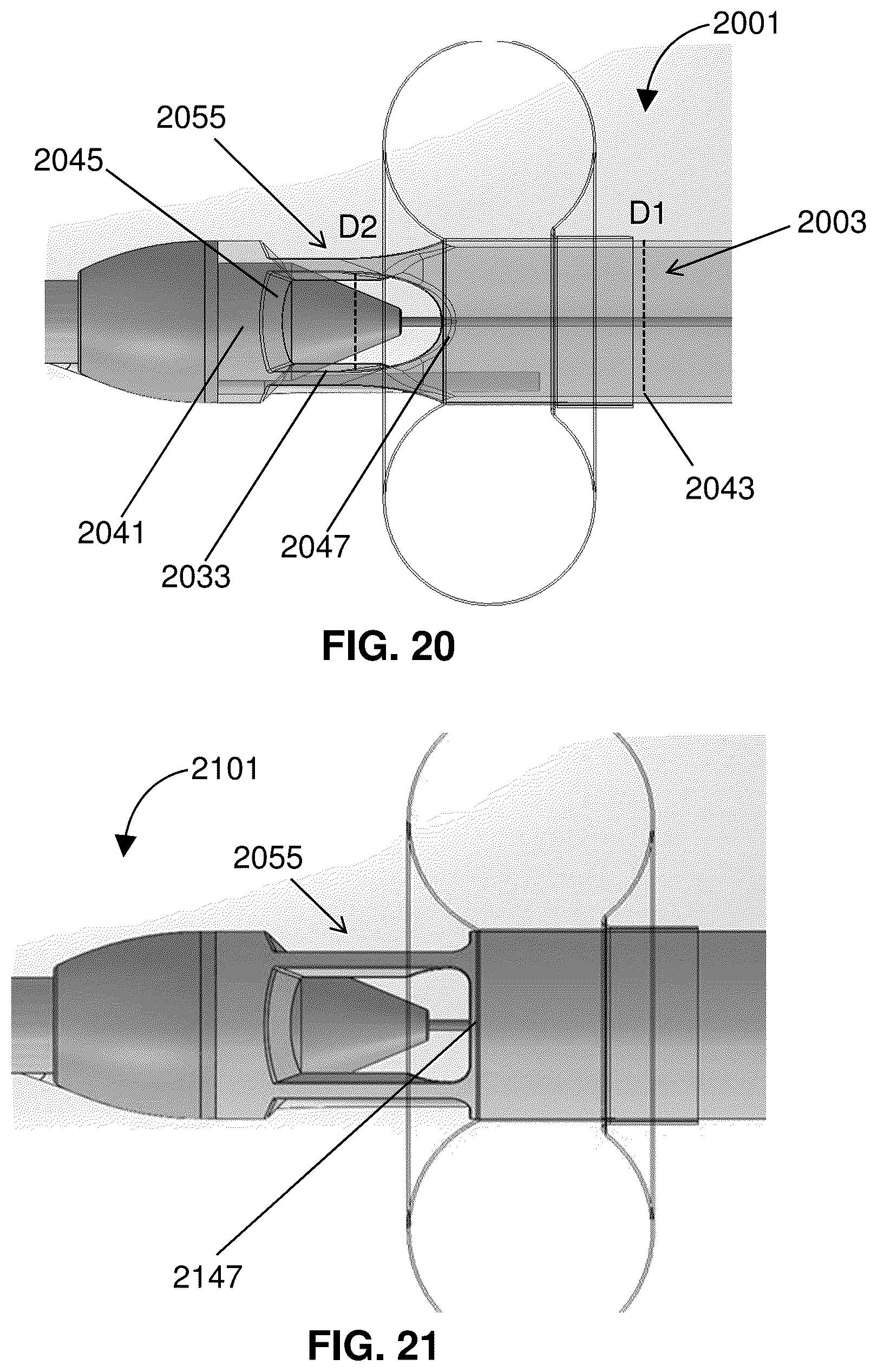 Patent US12318561 Figure 18 – Devices and methods for treating edema