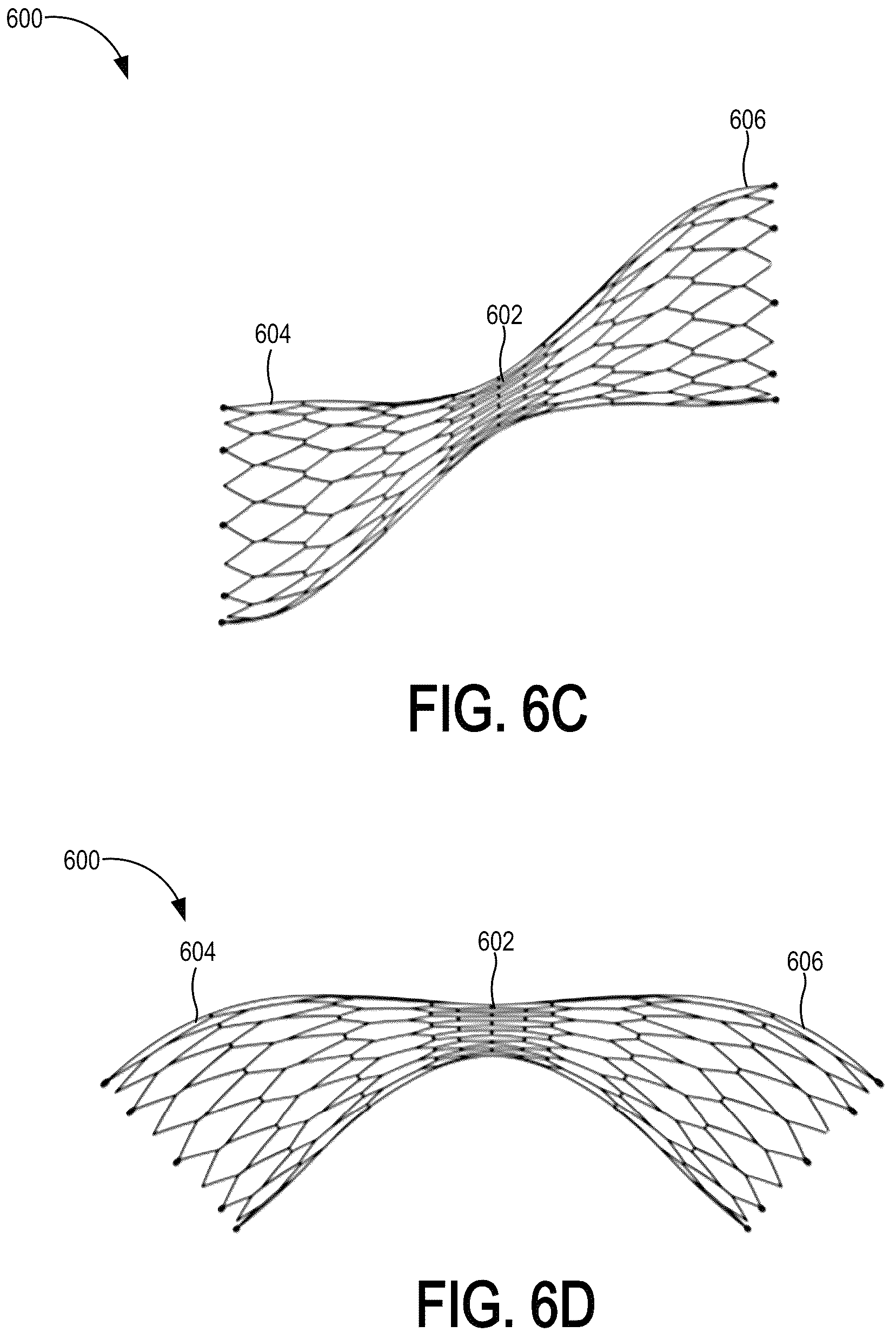 Patent US12318563 Figure 11 – Methods and systems for transcaval treatment of aneurysms