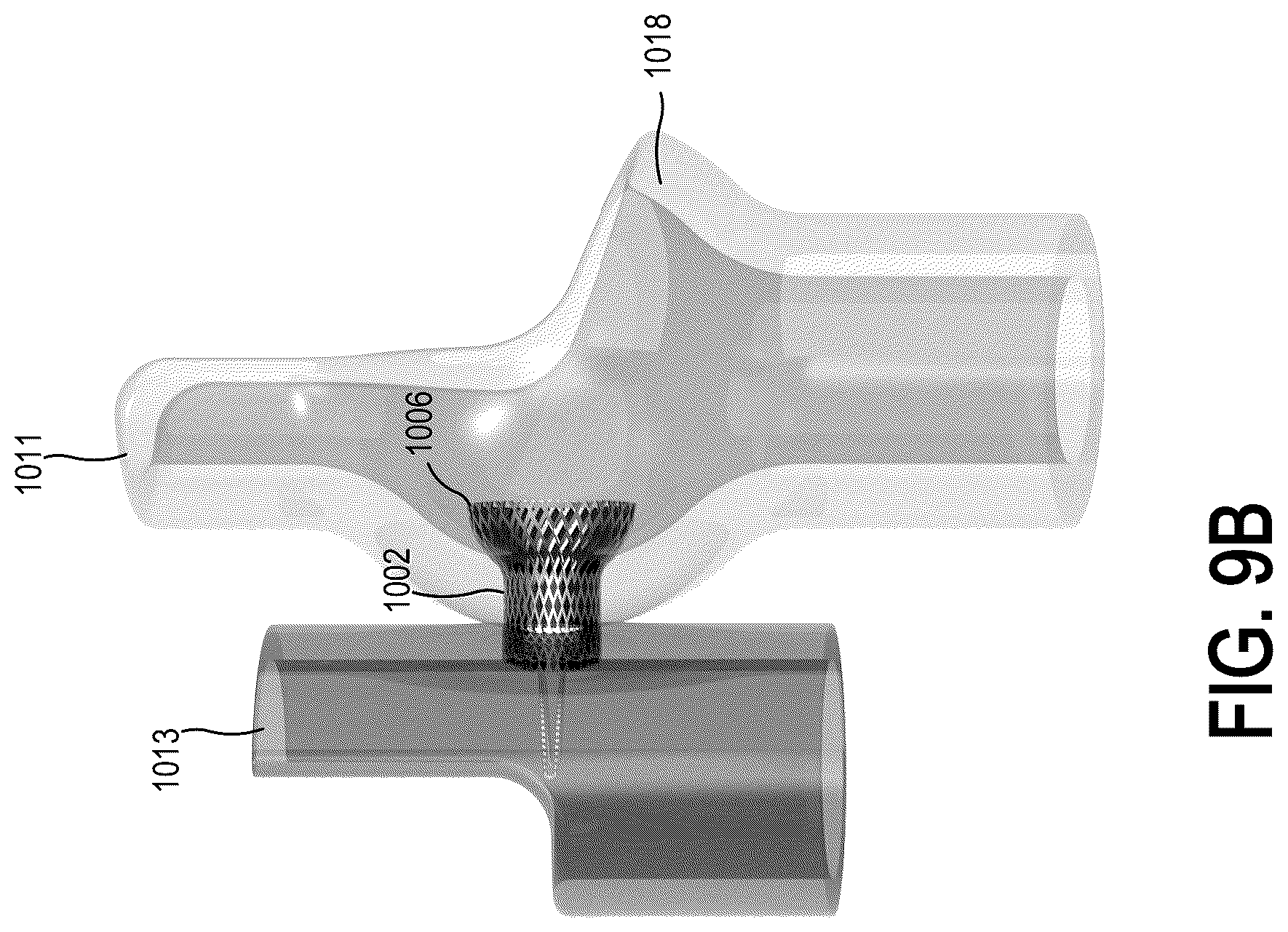 Patent US12318563 Figure 16 – Methods and systems for transcaval treatment of aneurysms