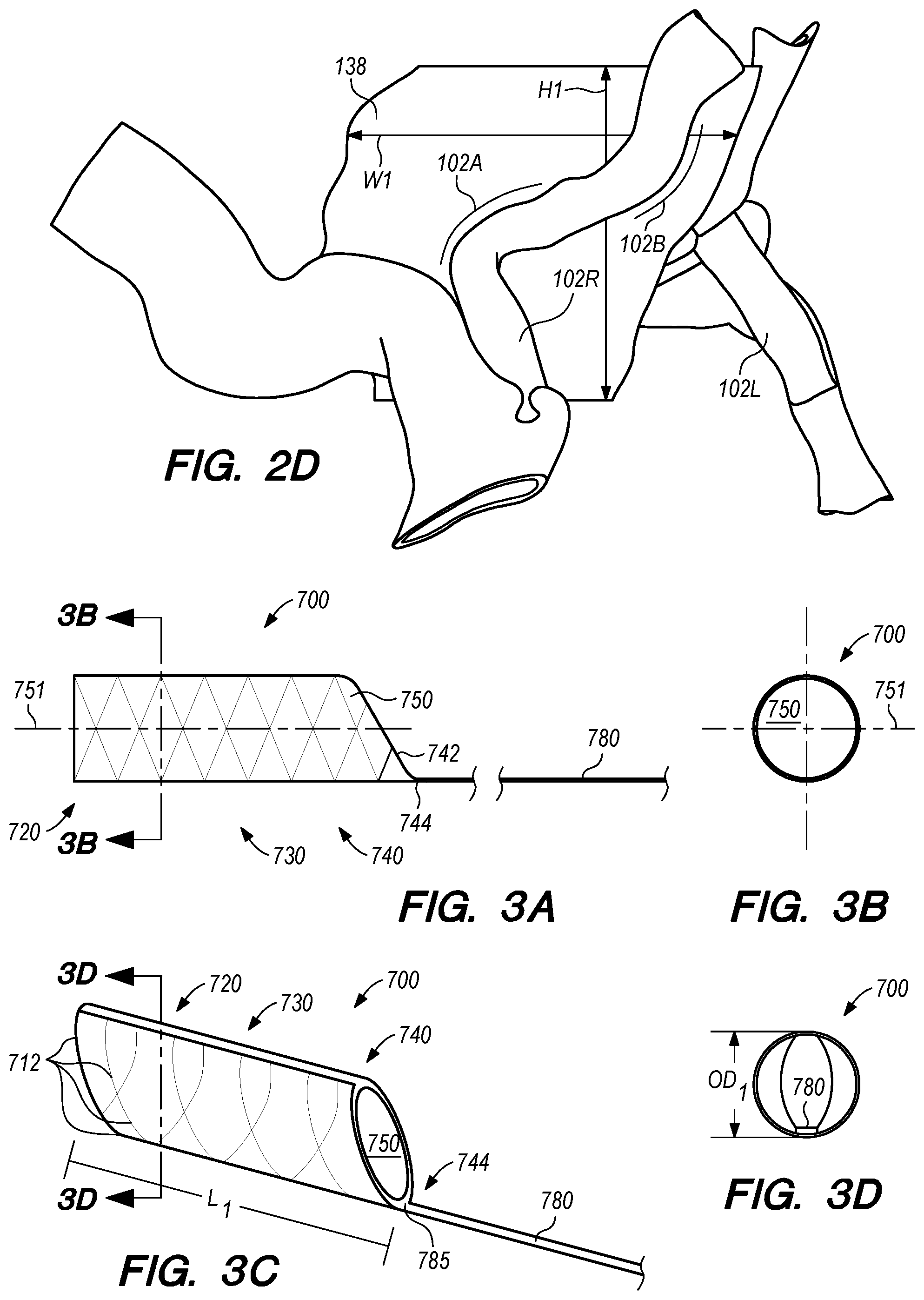 Patent US12318564 Figure 3 – Catheter systems and methods for medical procedures using catheters
