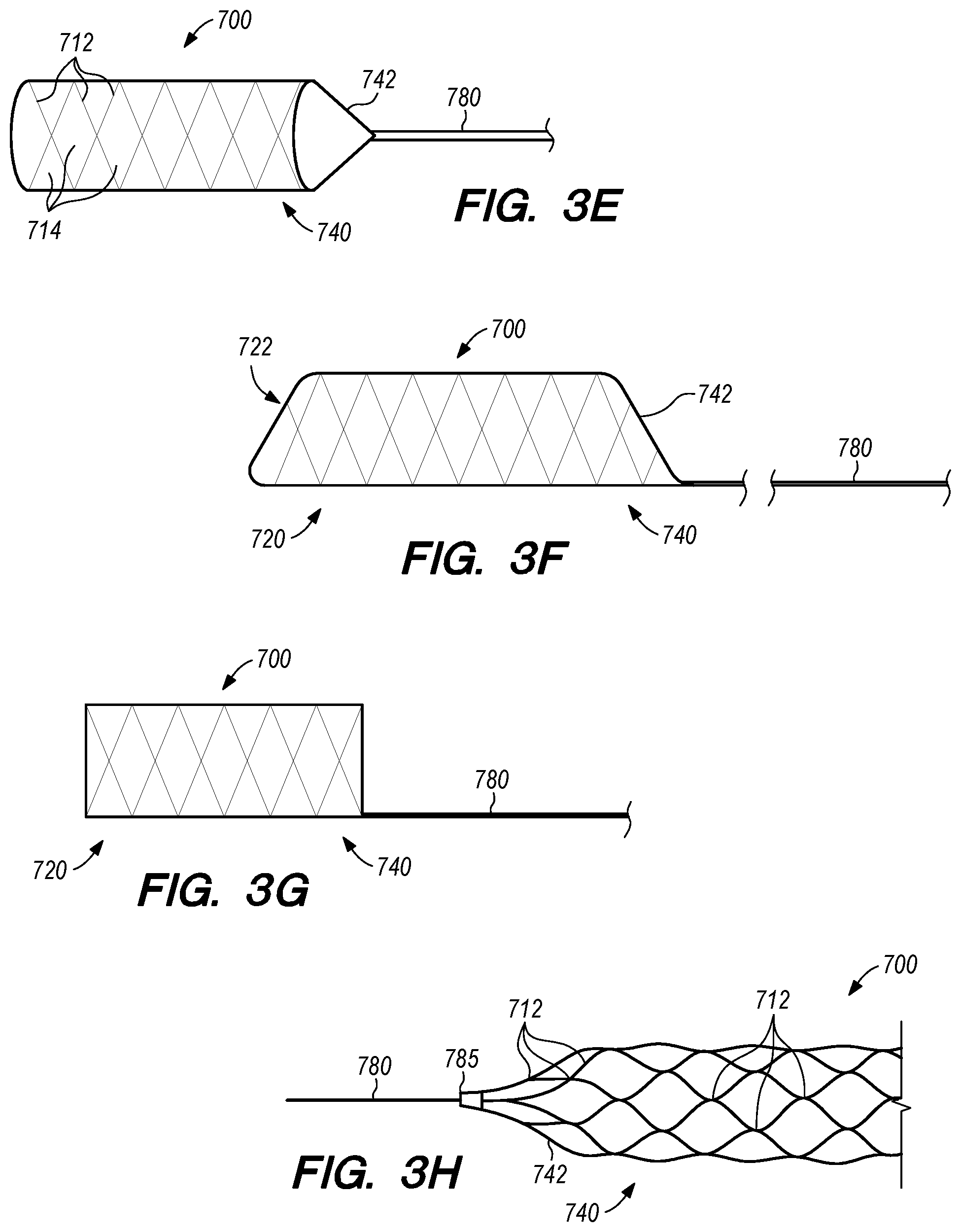 Patent US12318564 Figure 4 – Catheter systems and methods for medical procedures using catheters