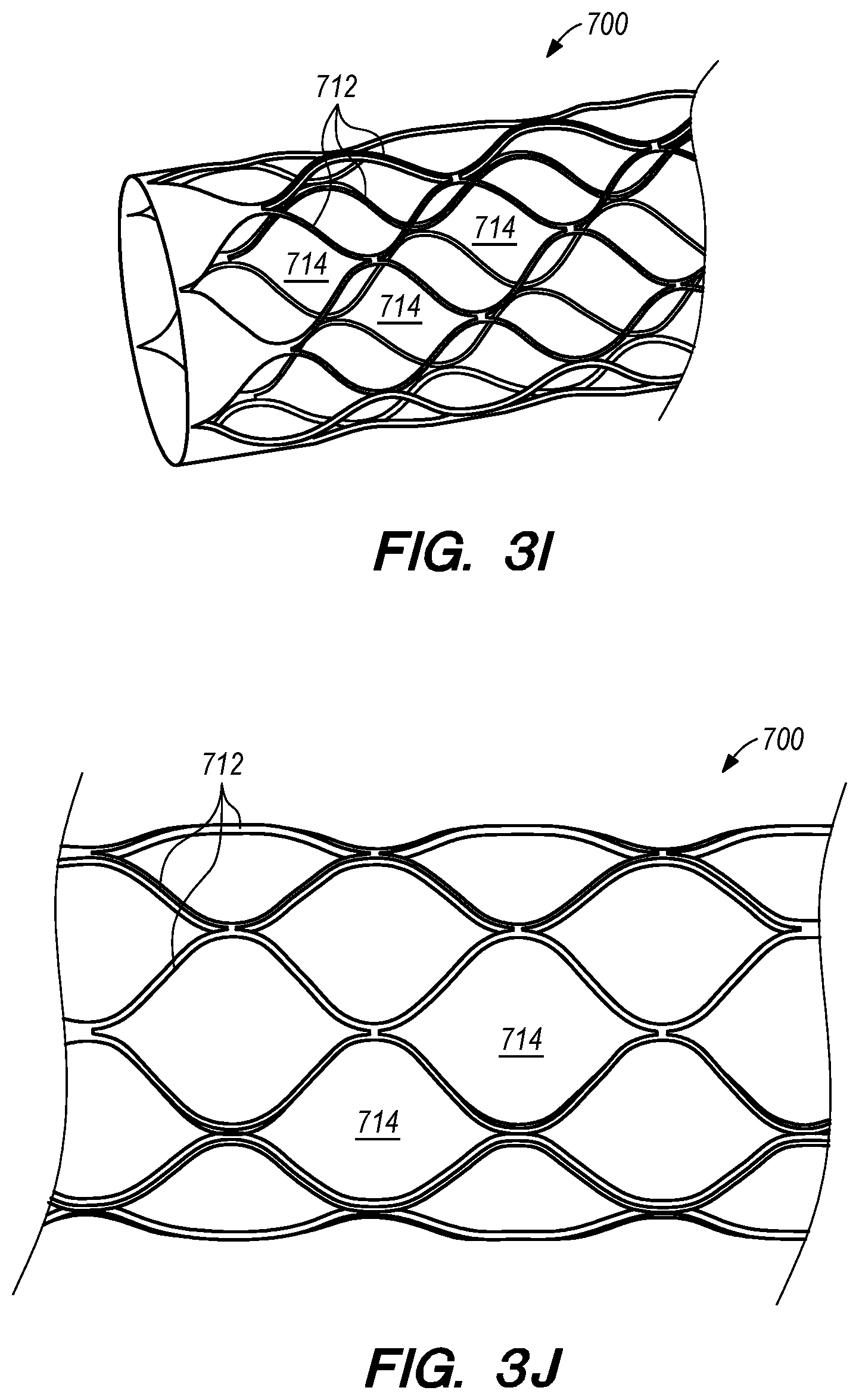 Patent US12318564 Figure 5 – Catheter systems and methods for medical procedures using catheters