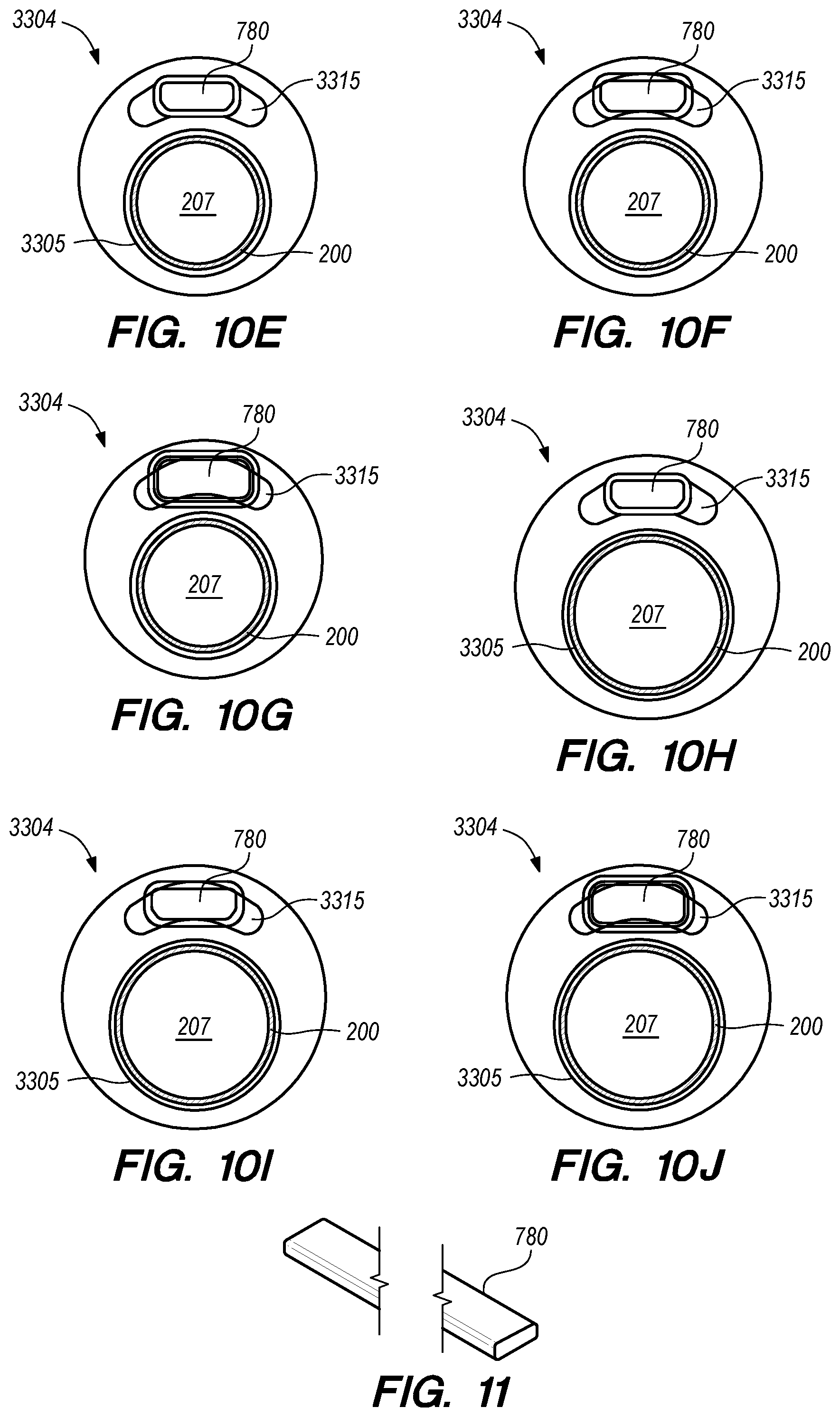Patent US12318564 Figure 18 – Catheter systems and methods for medical procedures using catheters
