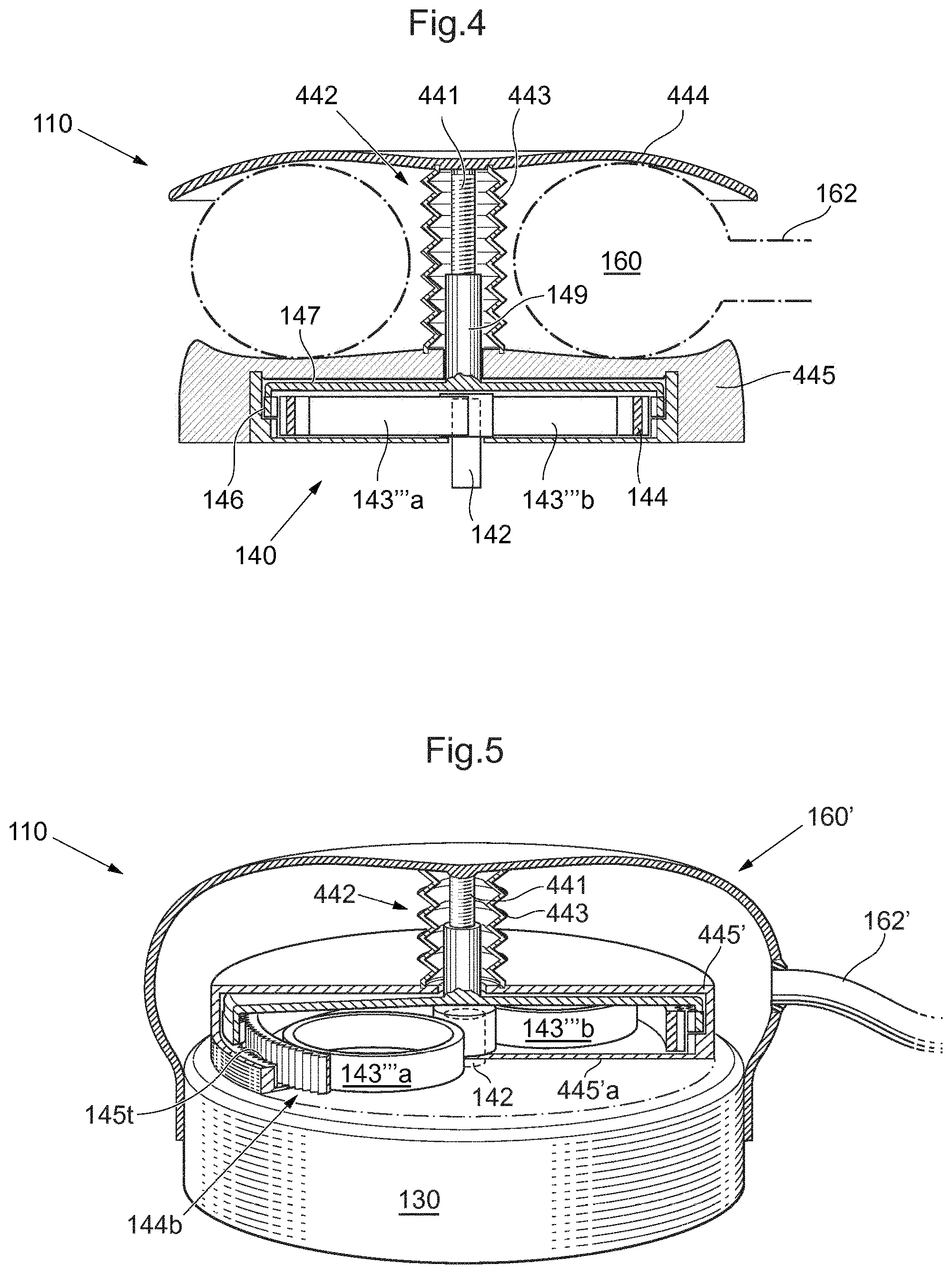 Patent US12318572 Figure 4 – Operable implant