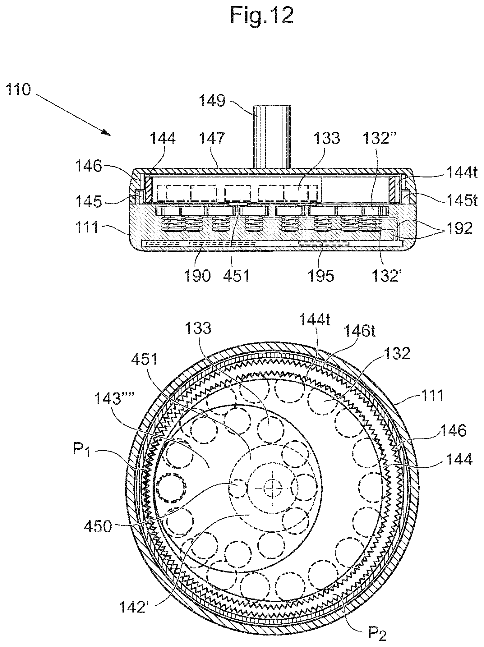 Patent US12318572 Figure 11 – Operable implant