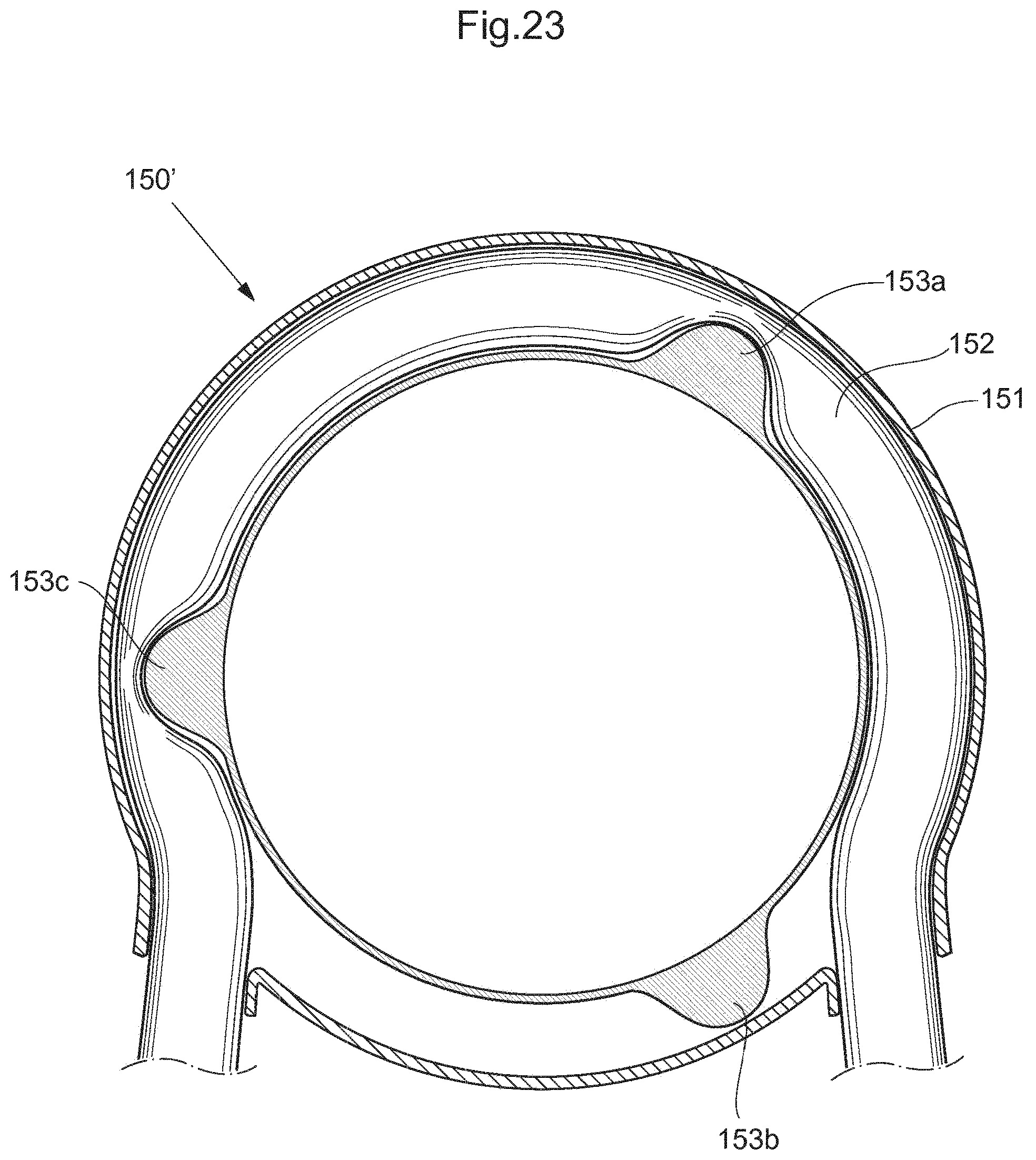 Patent US12318572 Figure 20 – Operable implant
