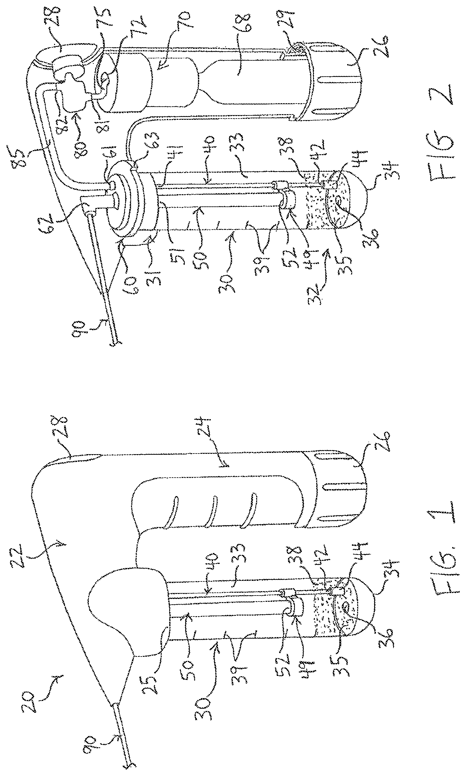 Patent US12318573 Figure 1 – Therapeutic agents for delivery using a catheter and pressure source