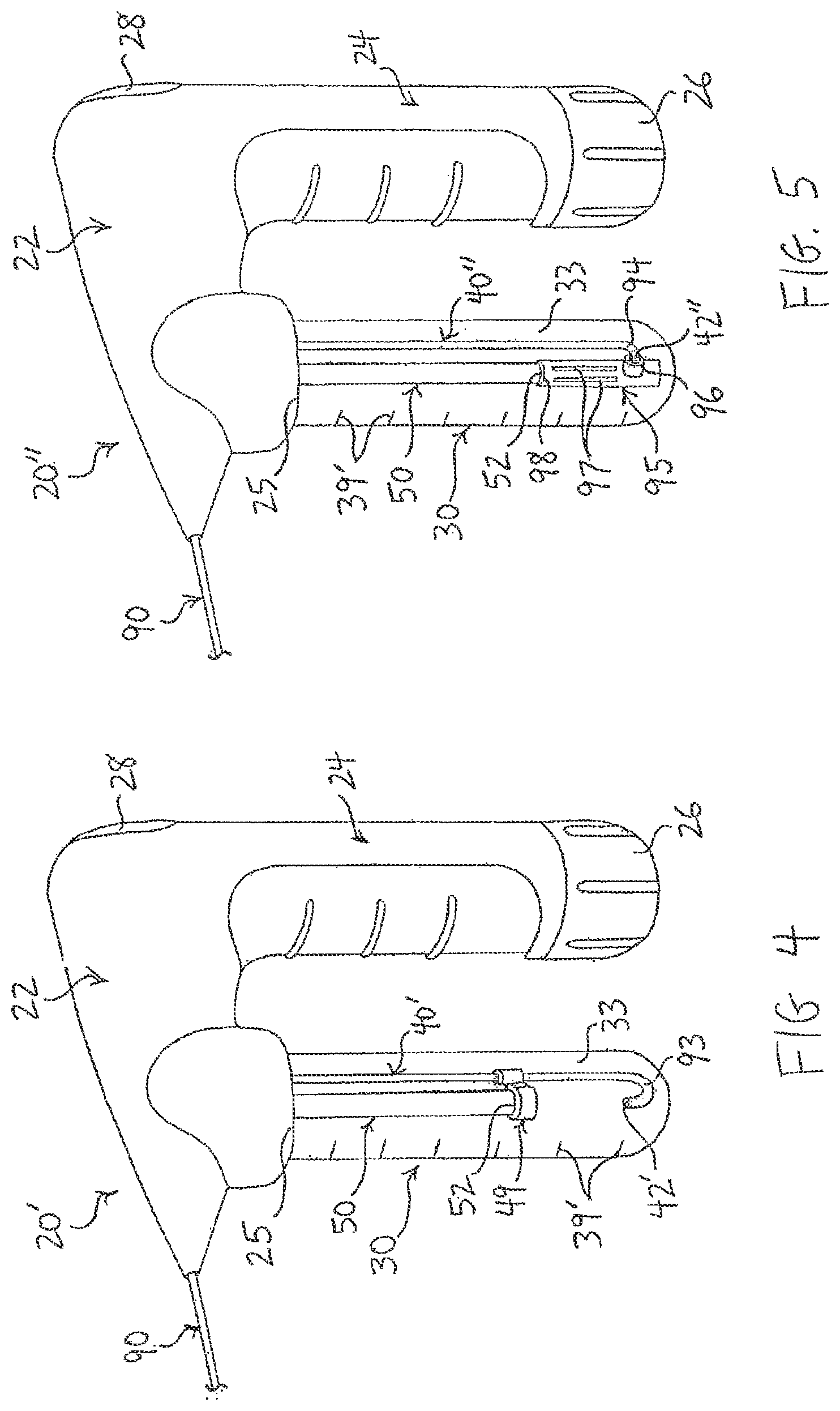 Patent US12318573 Figure 3 – Therapeutic agents for delivery using a catheter and pressure source