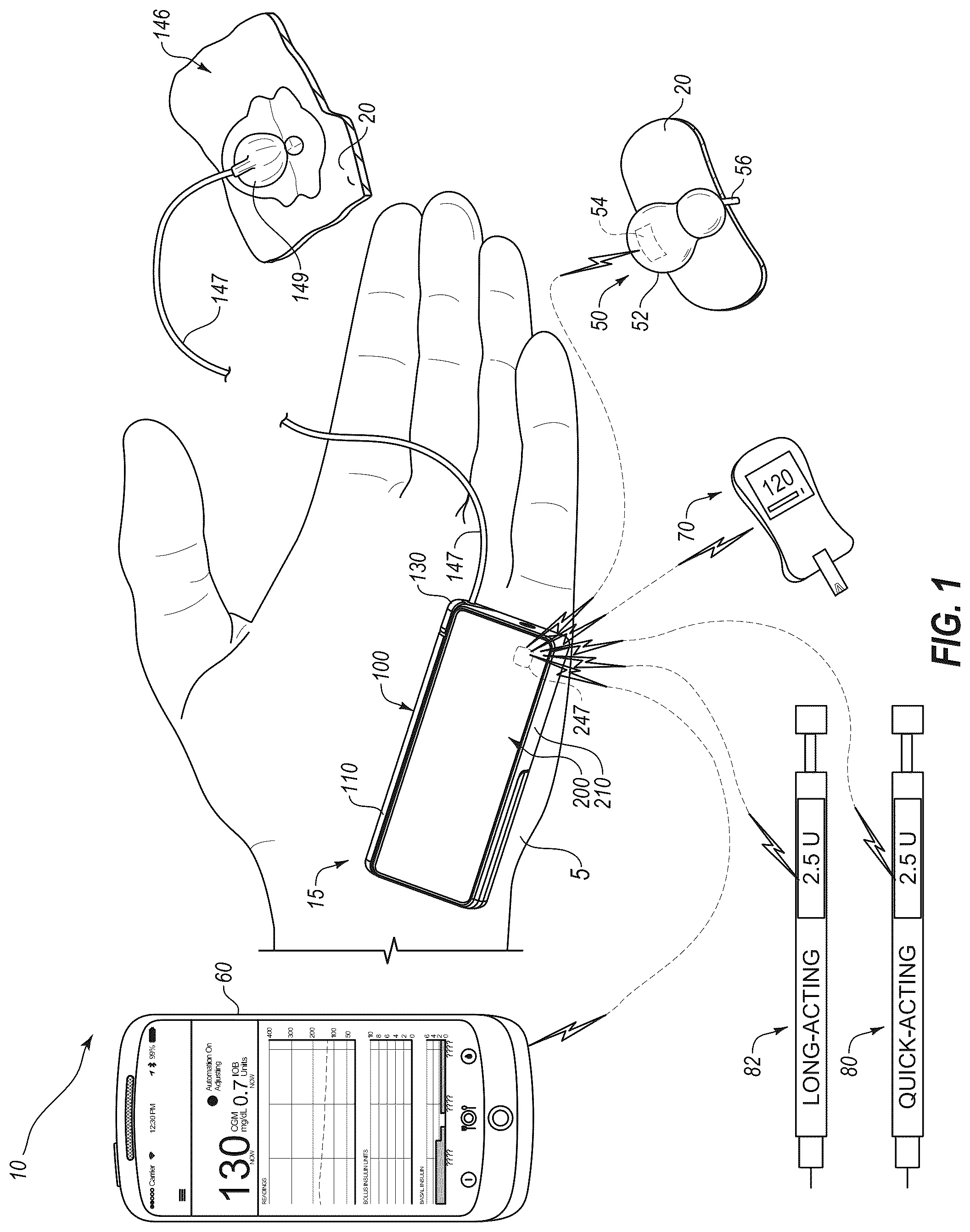 Patent US12318577 Figure 1 – System and method for adjusting insulin delivery