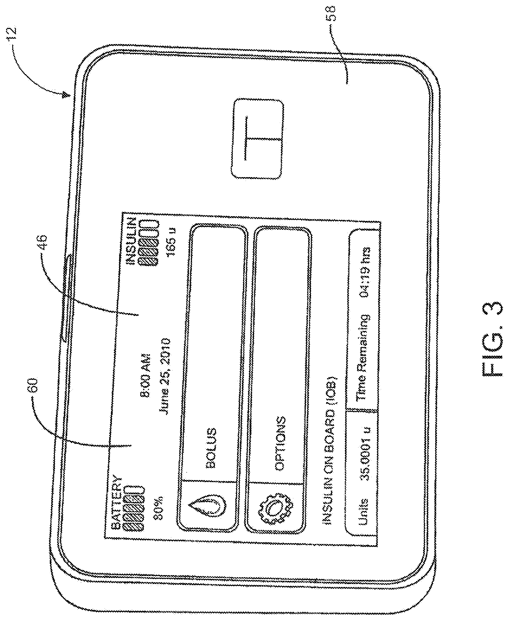 Patent US12318578 Figure 3 – System and method for switching between closed loop and open loop control of an ambulatory infusion pump