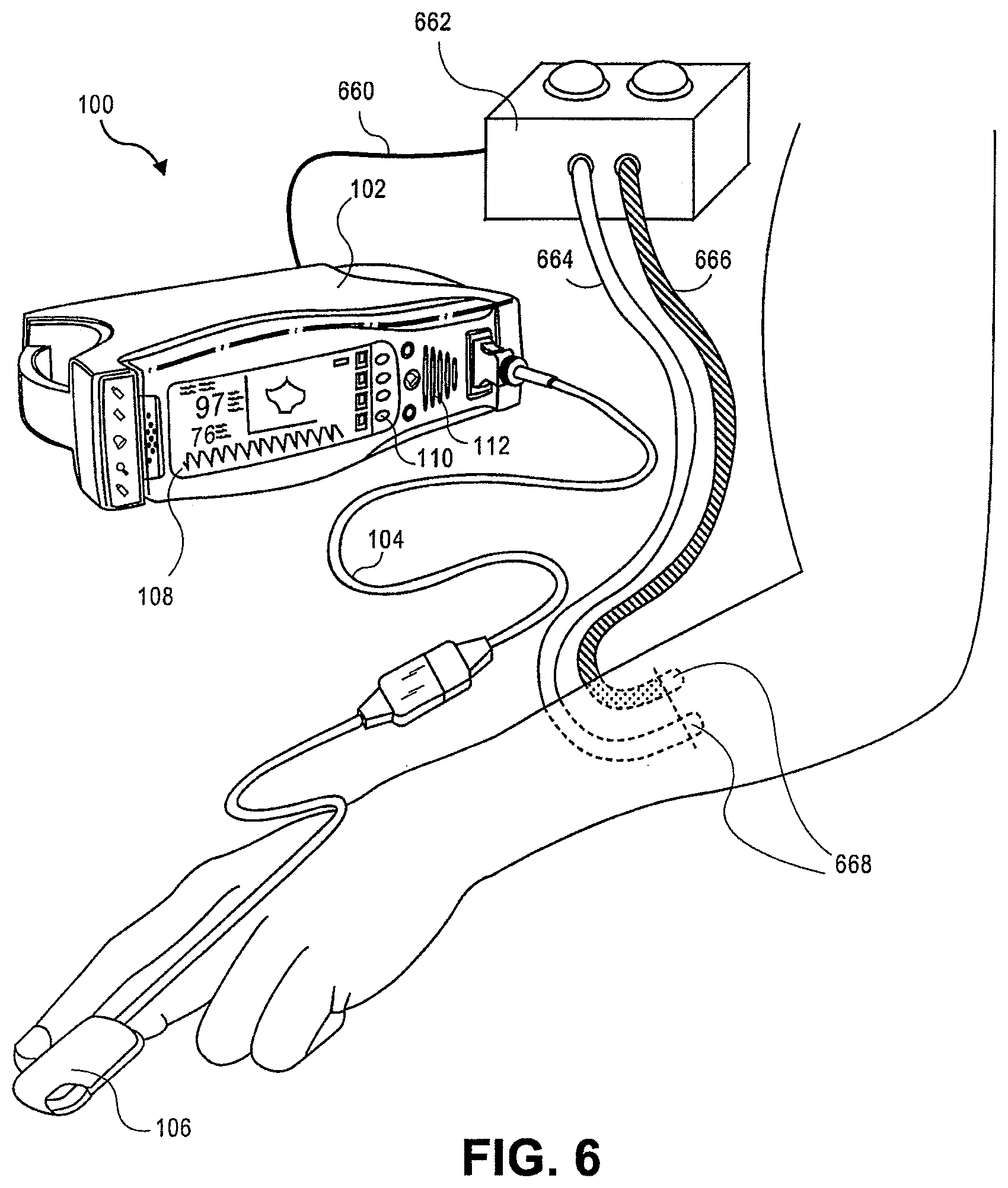 Patent US12318580 Figure 6 – Hemoglobin display and patient treatment