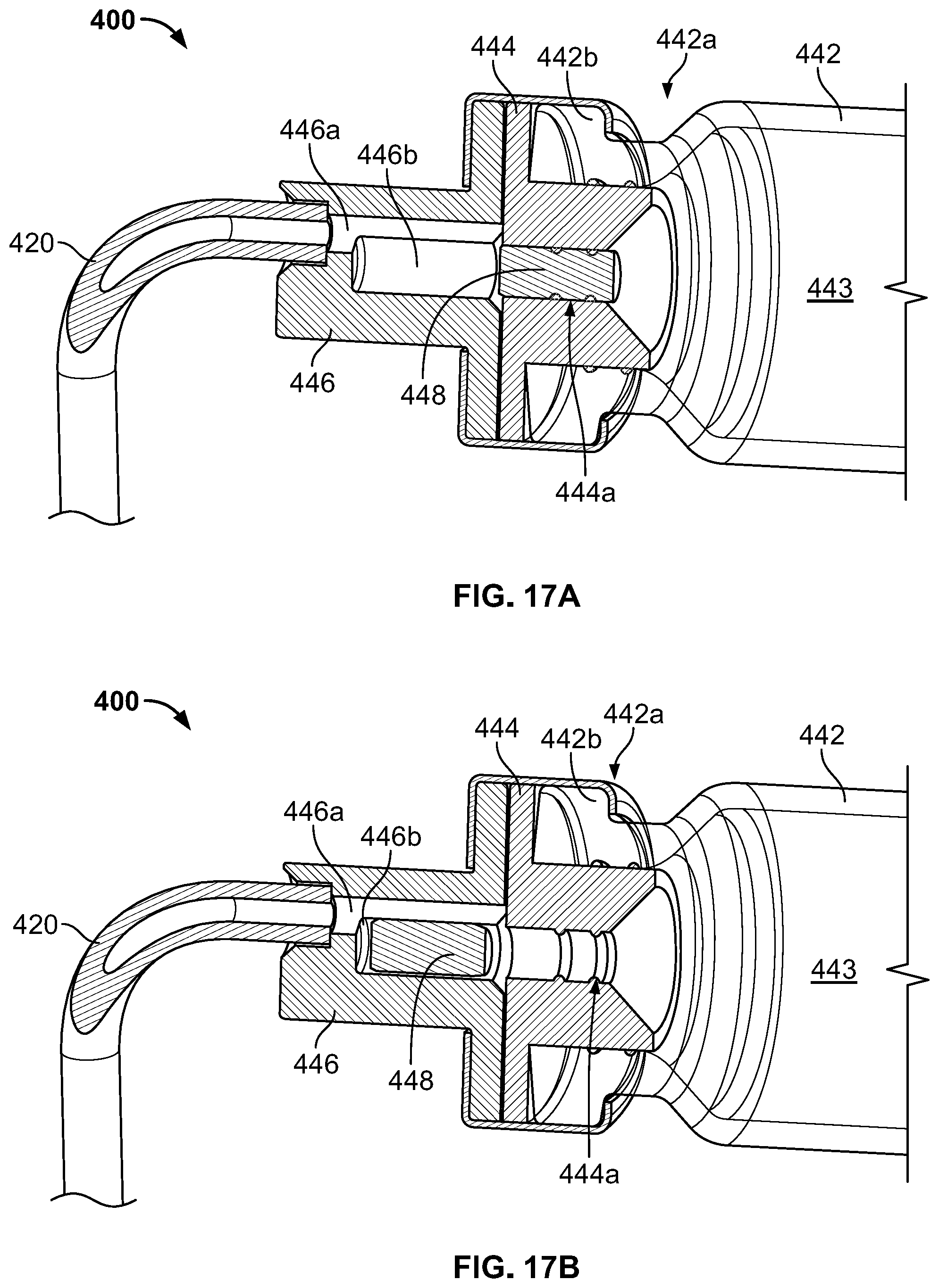 Patent US12318593 Figure 12 – Hydraulic-pneumatic pressurized chamber drug delivery system