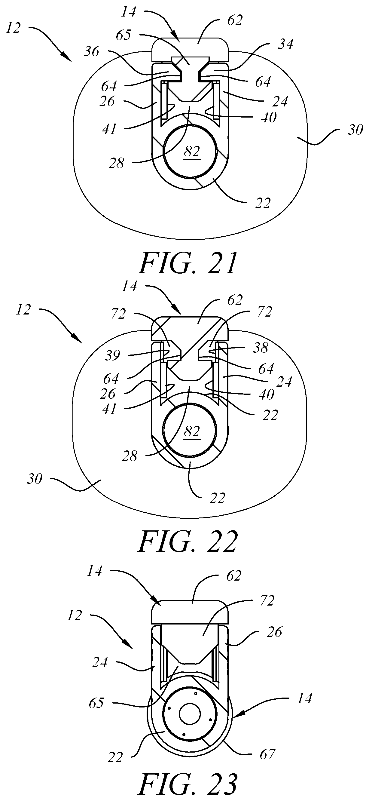 Patent US12318598 Figure 12 – Medical syringe