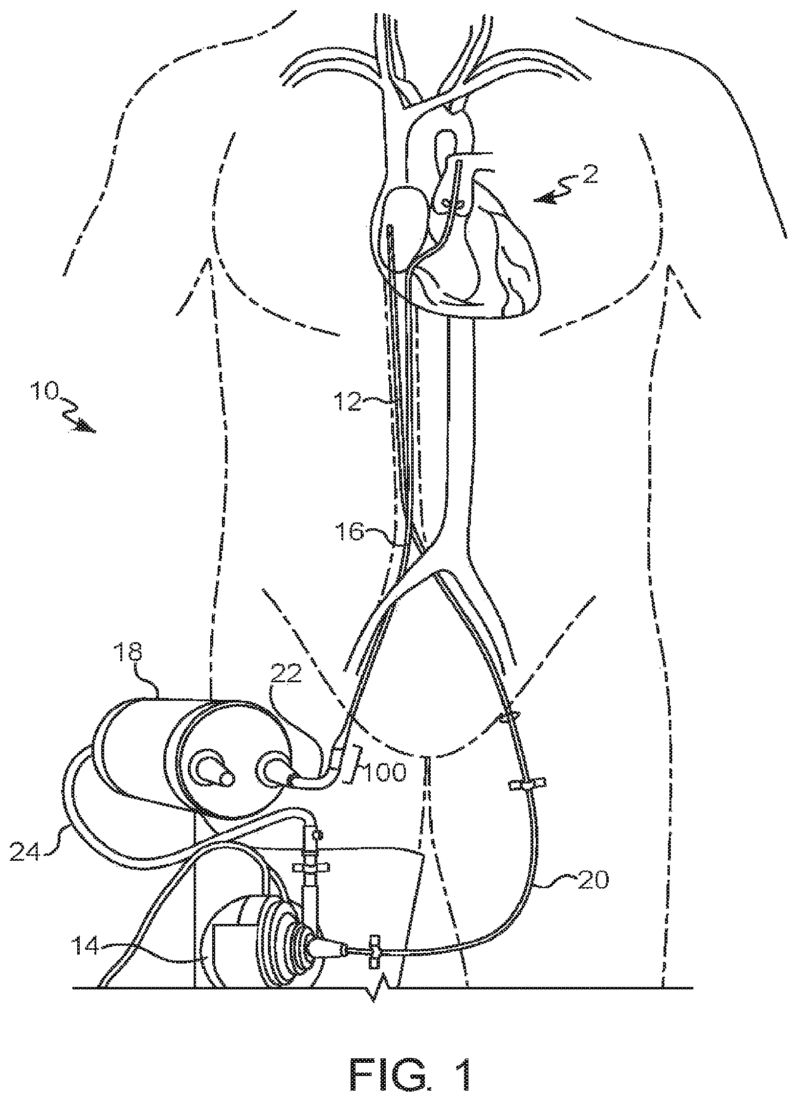 Patent US12318600 Figure 1 – Sterile connector and cannula assembly