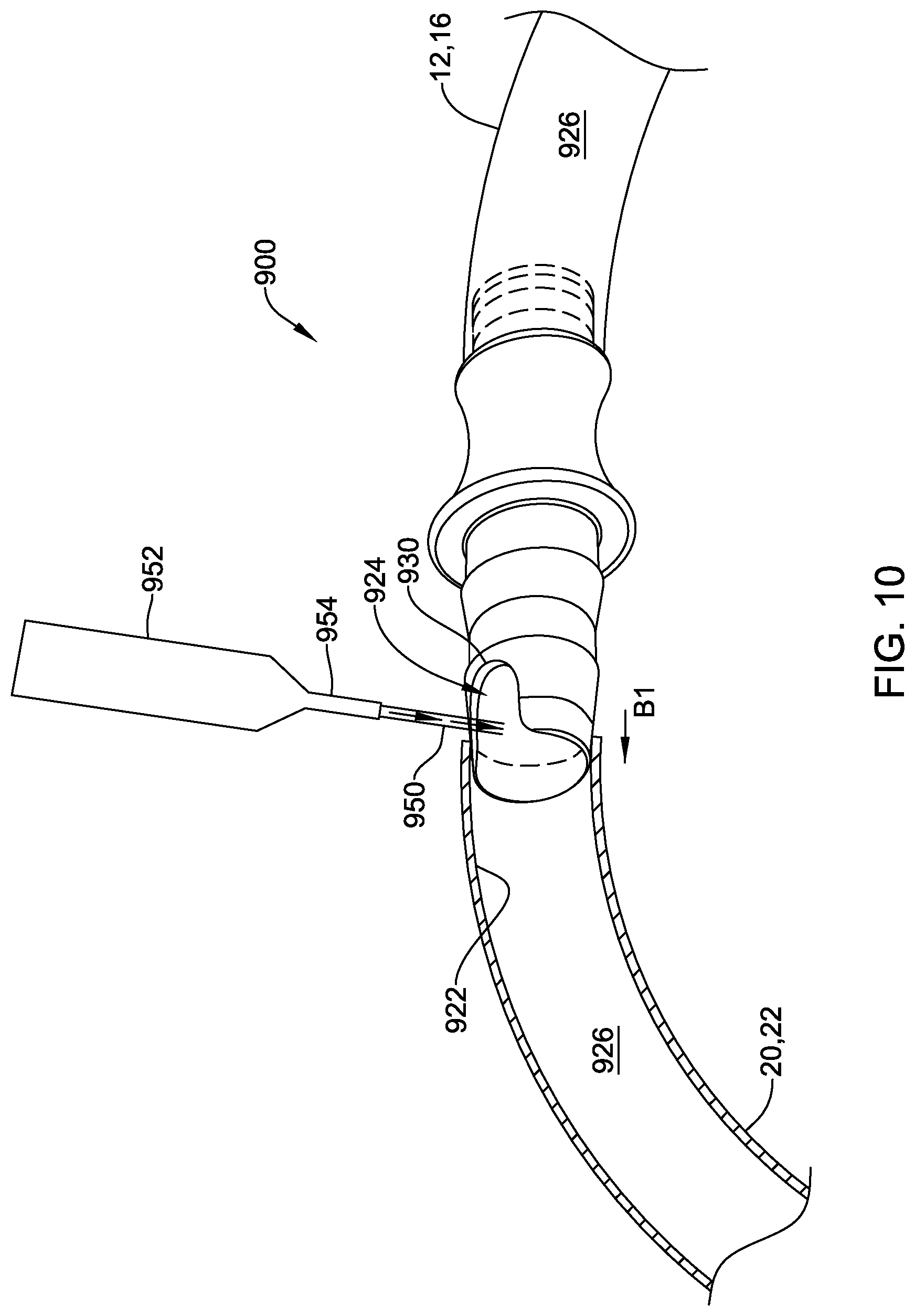 Patent US12318600 Figure 11 – Sterile connector and cannula assembly