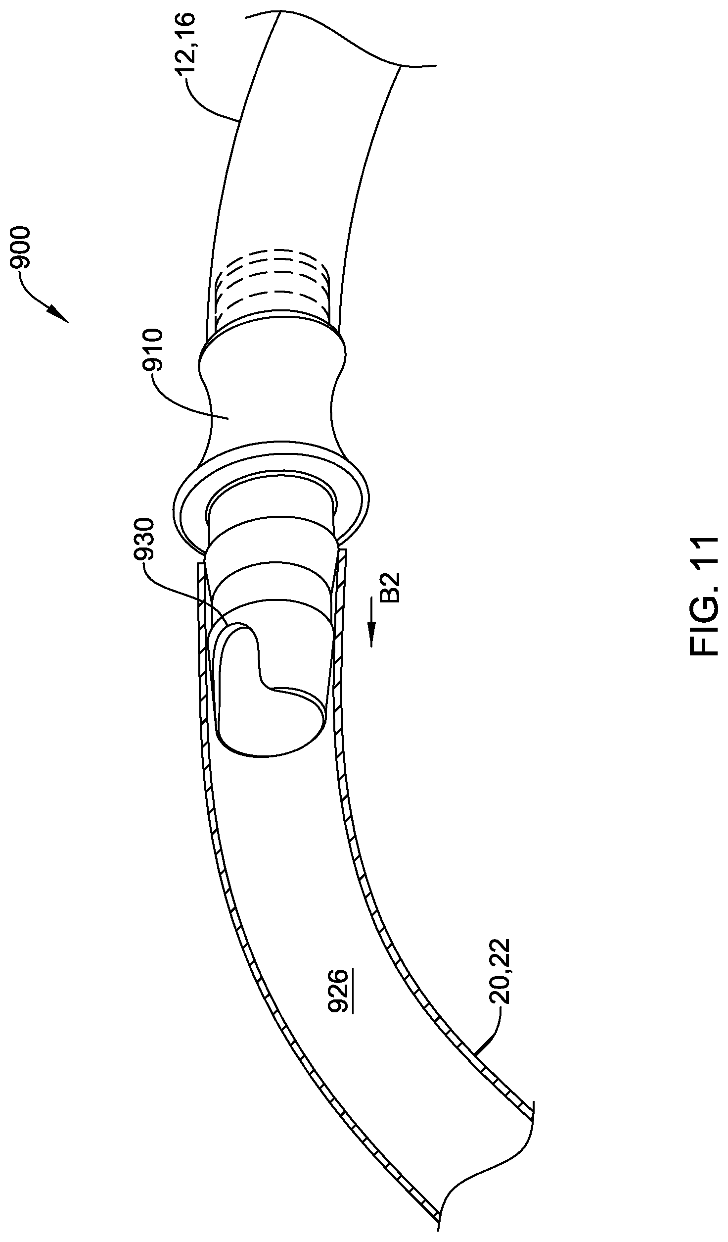 Patent US12318600 Figure 12 – Sterile connector and cannula assembly