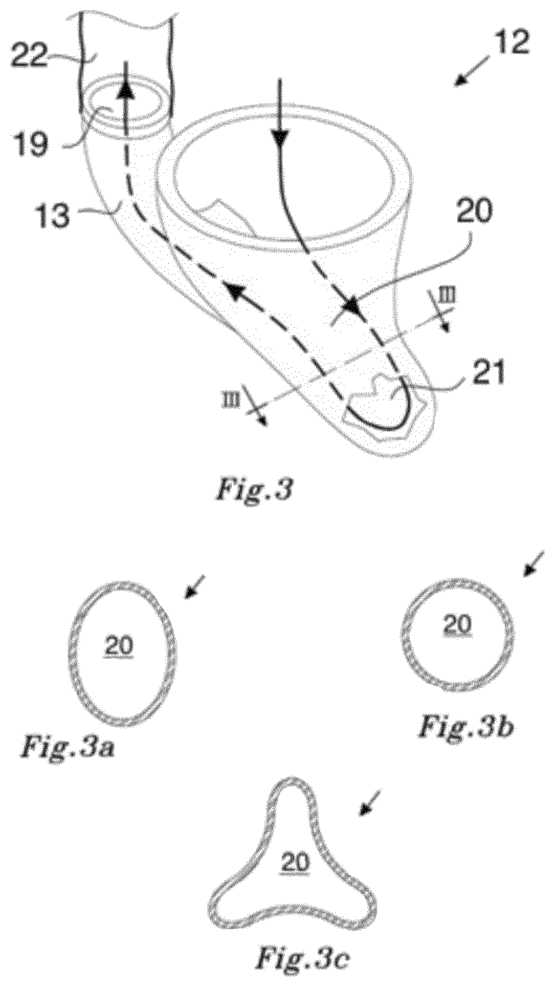 Patent US12318603 Figure 3 – Blood pumping device