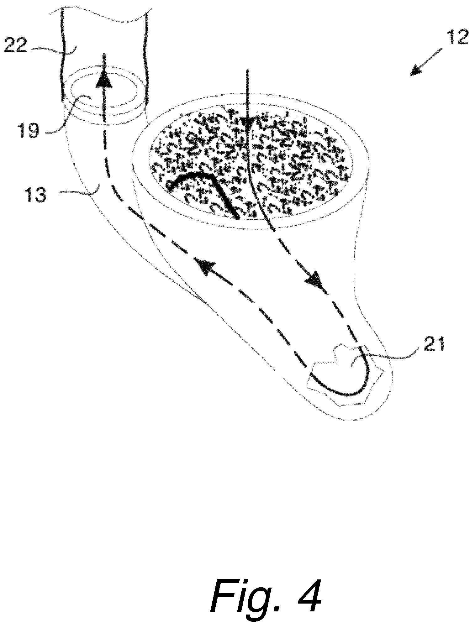 Patent US12318603 Figure 4 – Blood pumping device