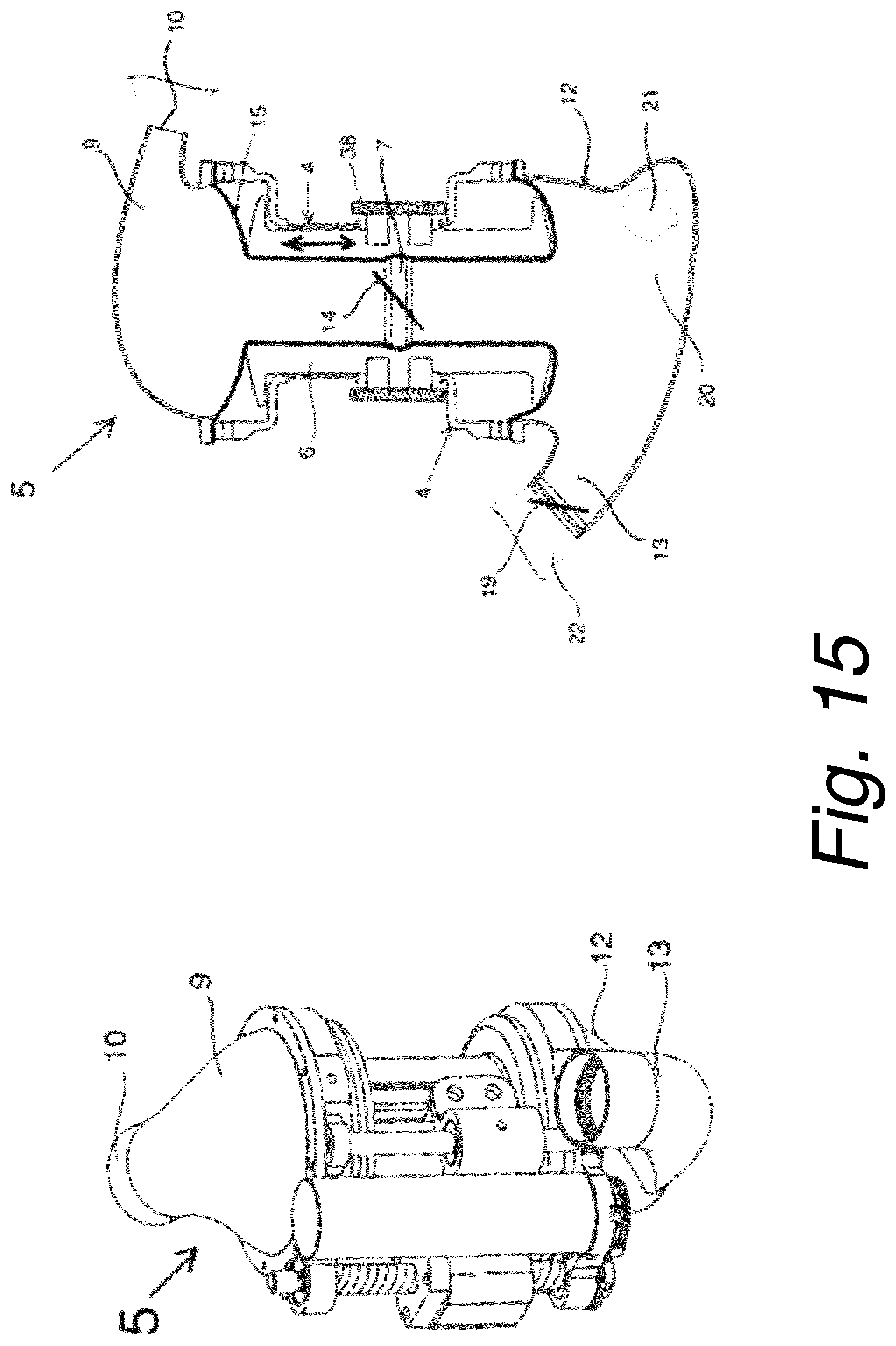 Patent US12318603 Figure 14 – Blood pumping device
