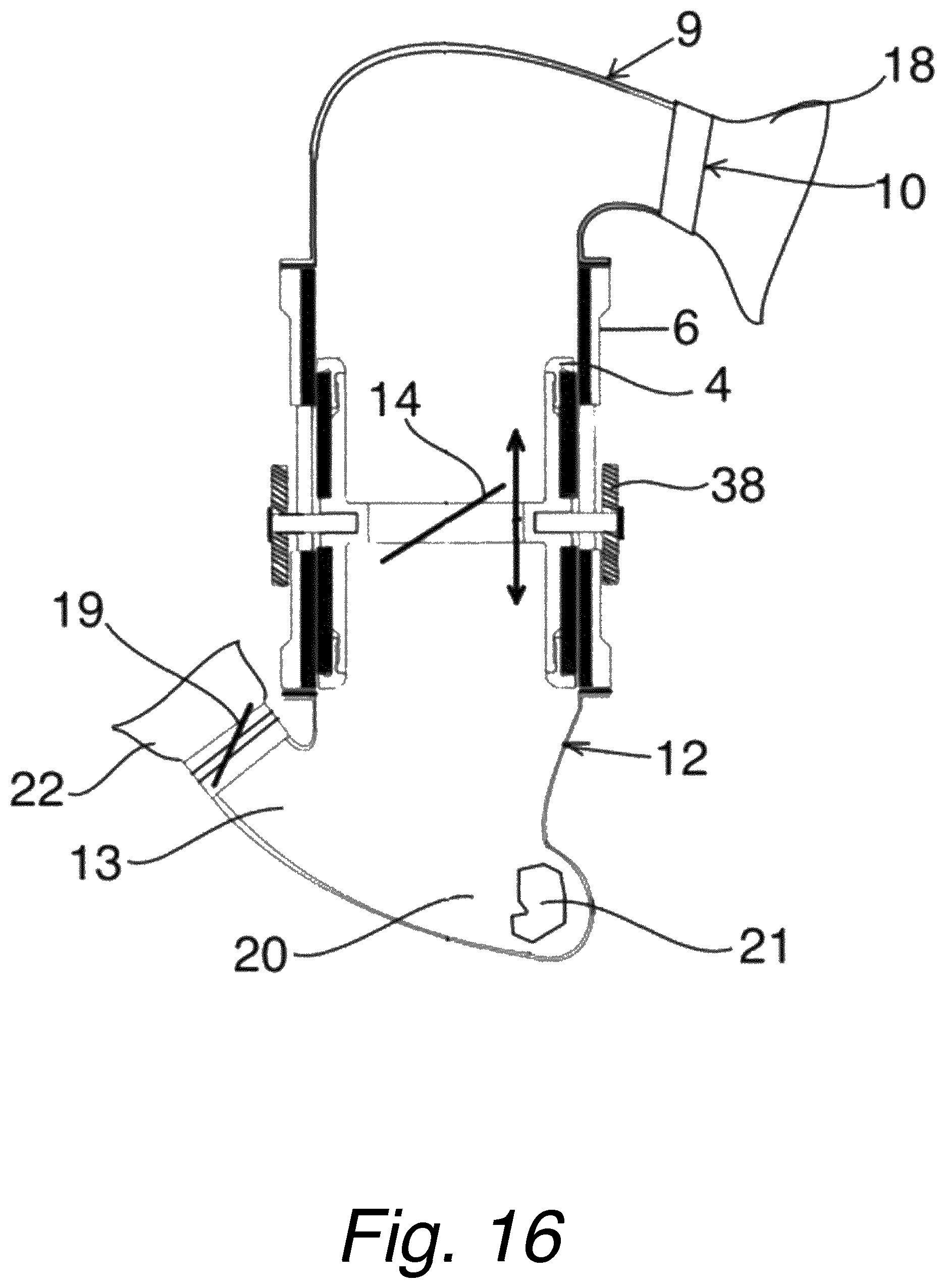 Patent US12318603 Figure 15 – Blood pumping device