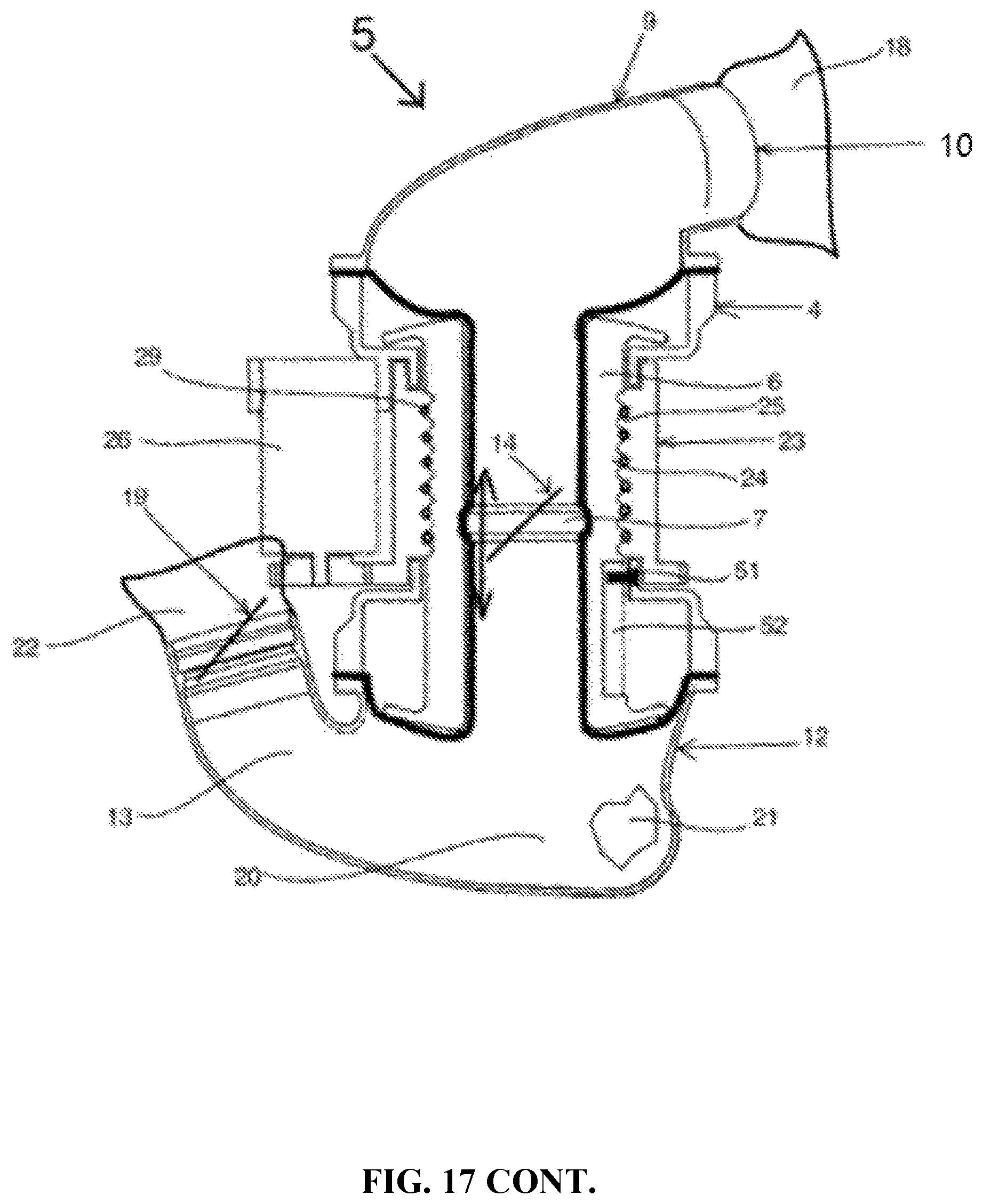 Patent US12318603 Figure 17 – Blood pumping device