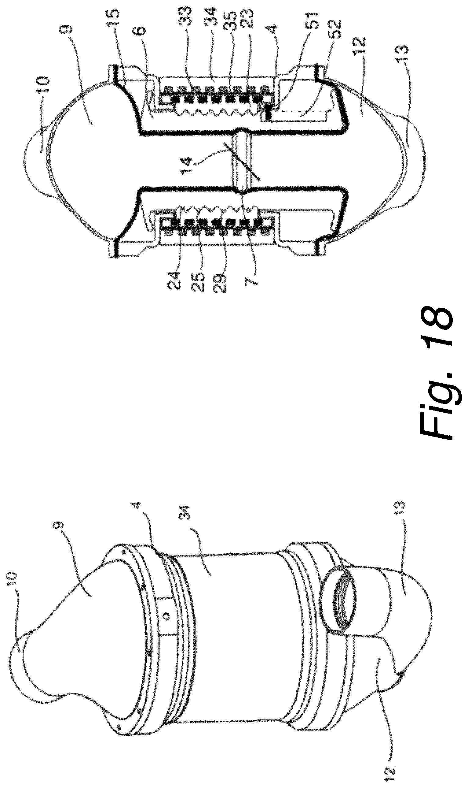 Patent US12318603 Figure 18 – Blood pumping device