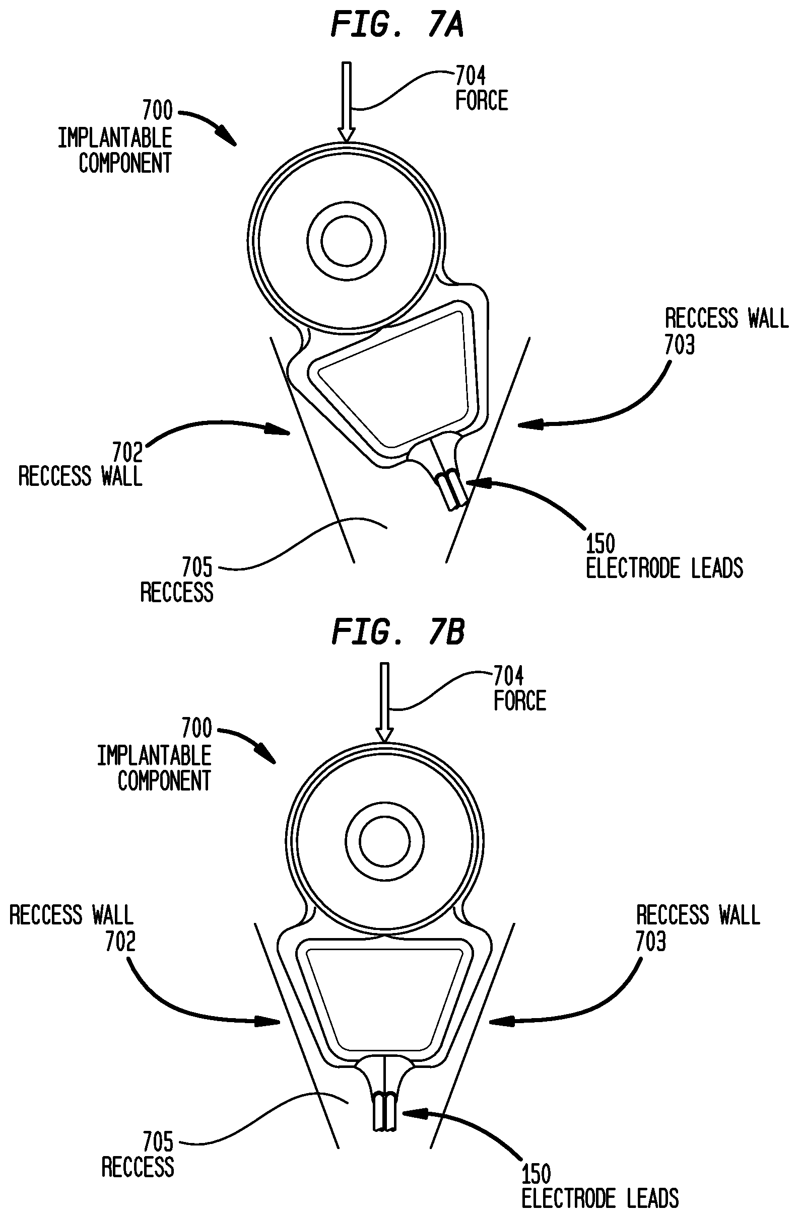 Patent US12318605 Figure 10 – Implantable device migration control